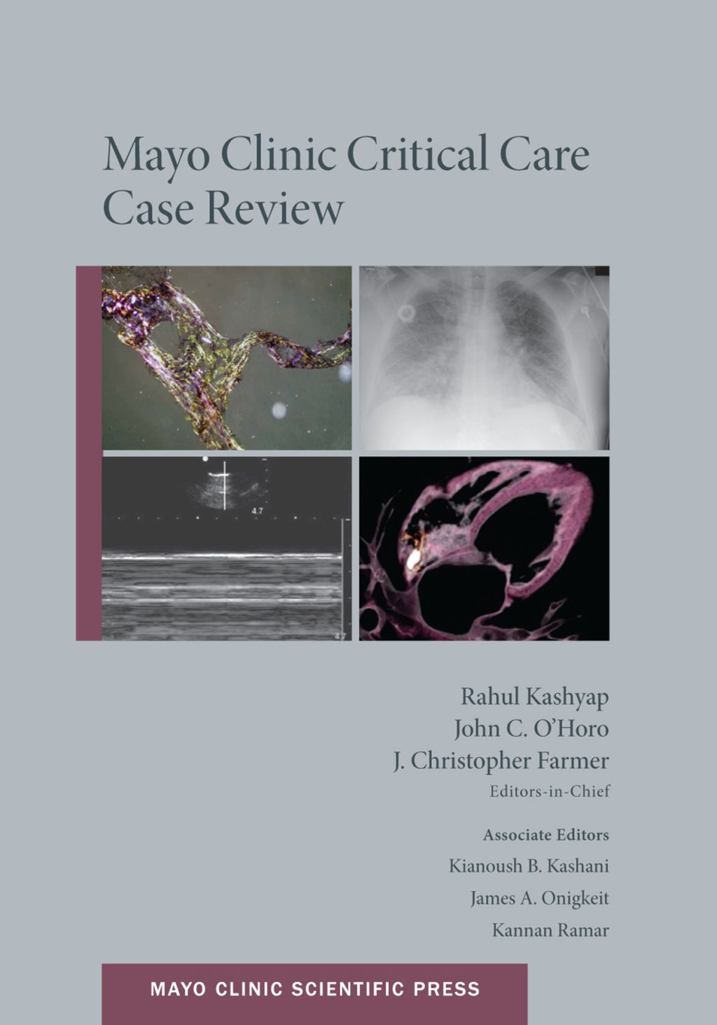 Mayo Clinic Critical Care Case Review 1st Edition â€“ PDF/EPUB Version Downloadable