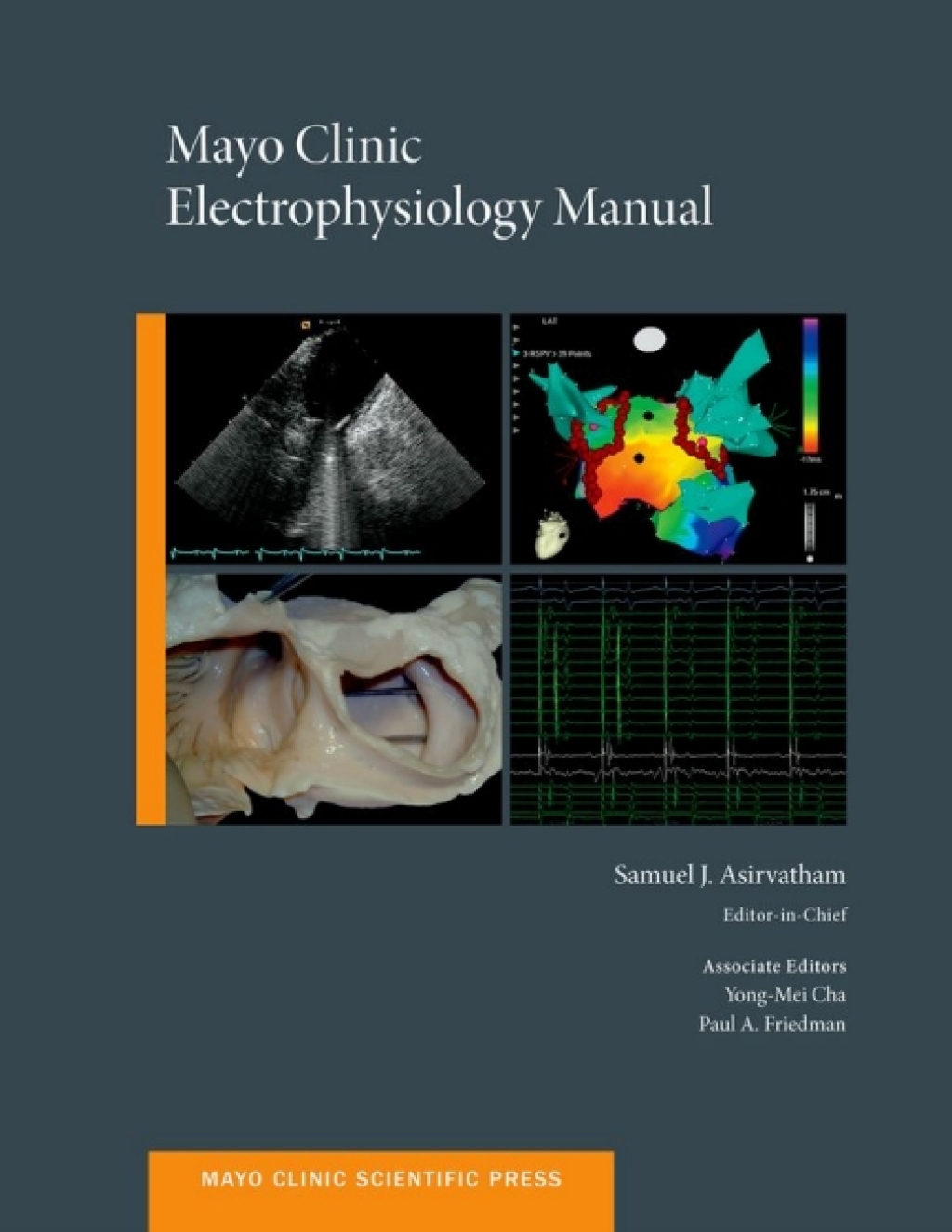 Mayo Clinic Electrophysiology Manual 1st Edition â€“ PDF/EPUB Version Downloadable