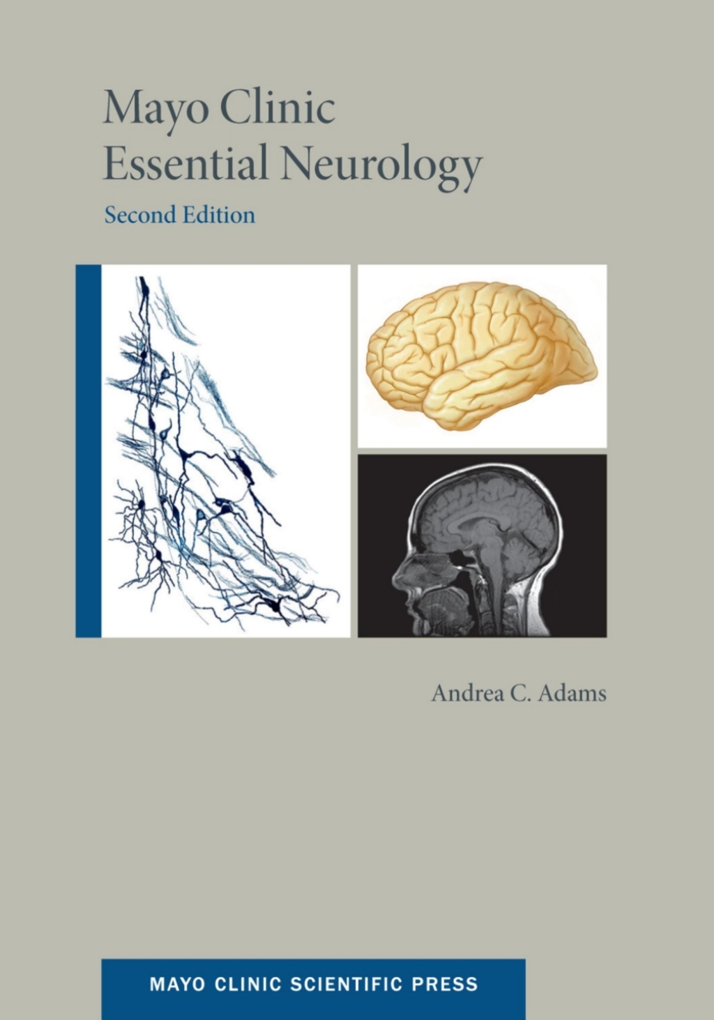 Mayo Clinic Essential Neurology 2nd Edition â€“ PDF/EPUB Version Downloadable