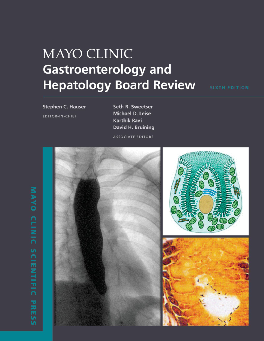 Mayo Clinic Gastroenterology and Hepatology Board Review 6th Edition â€“ PDF/EPUB Version Downloadable