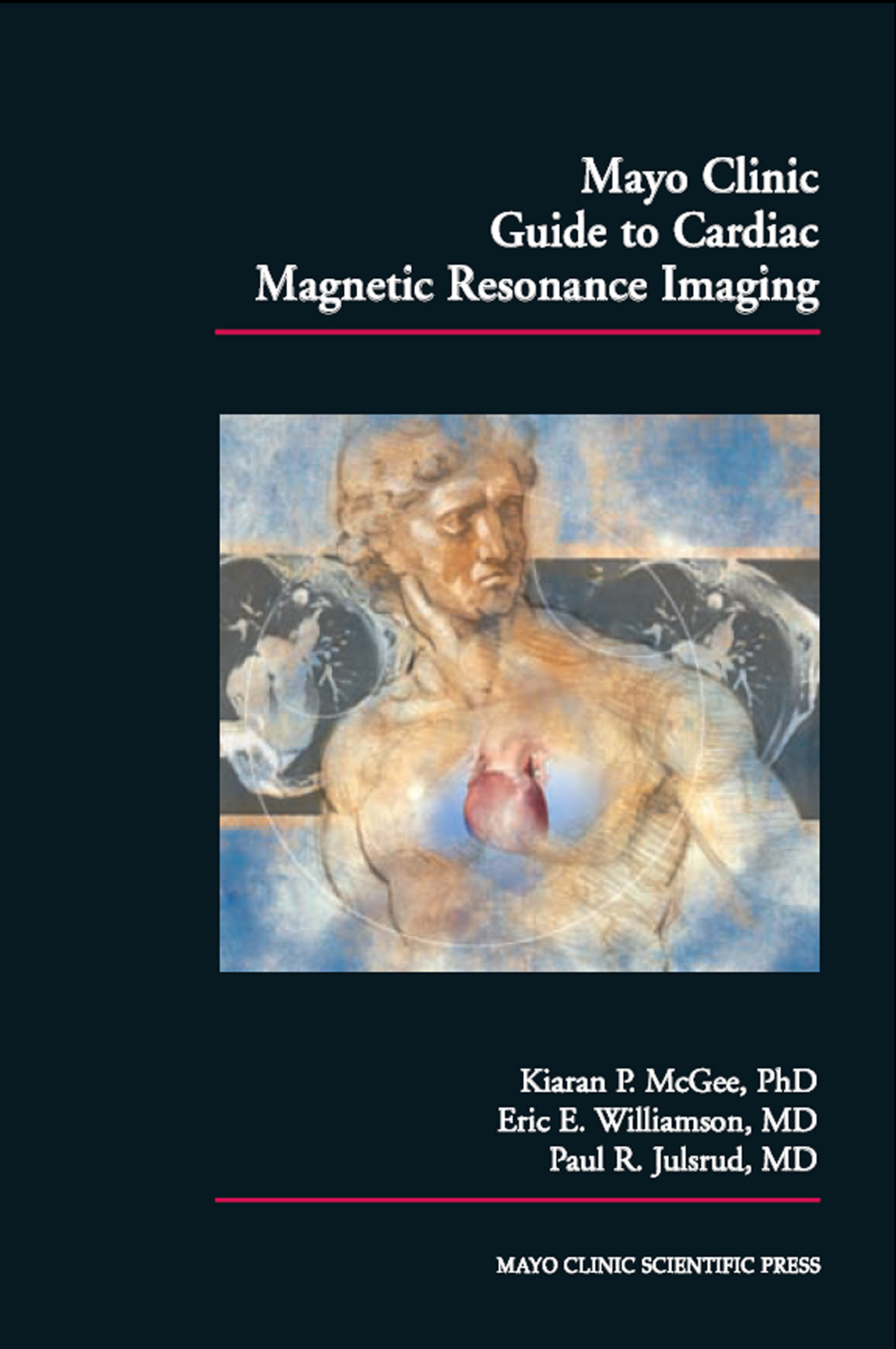 Mayo Clinic Guide to Cardiac Magnetic Resonance Imaging 1st Edition â€“ PDF/EPUB Version Downloadable