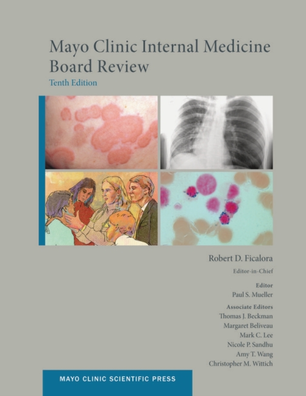 Mayo Clinic Internal Medicine Board Review 10th Edition â€“ PDF/EPUB Version Downloadable