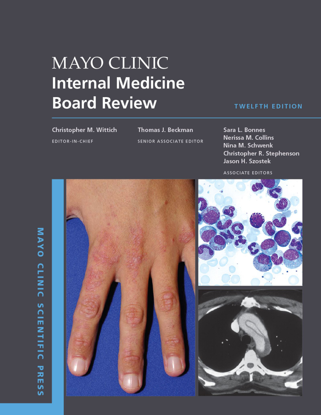 Mayo Clinic Internal Medicine Board Review 12th Edition â€“ PDF/EPUB Version Downloadable