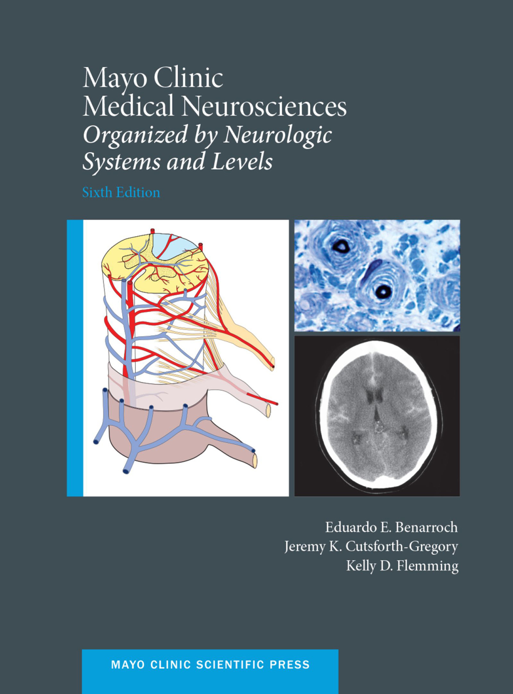Mayo Clinic Medical Neurosciences Organized by Neurologic System and Level 6th Edition â€“ PDF/EPUB Version Downloadable