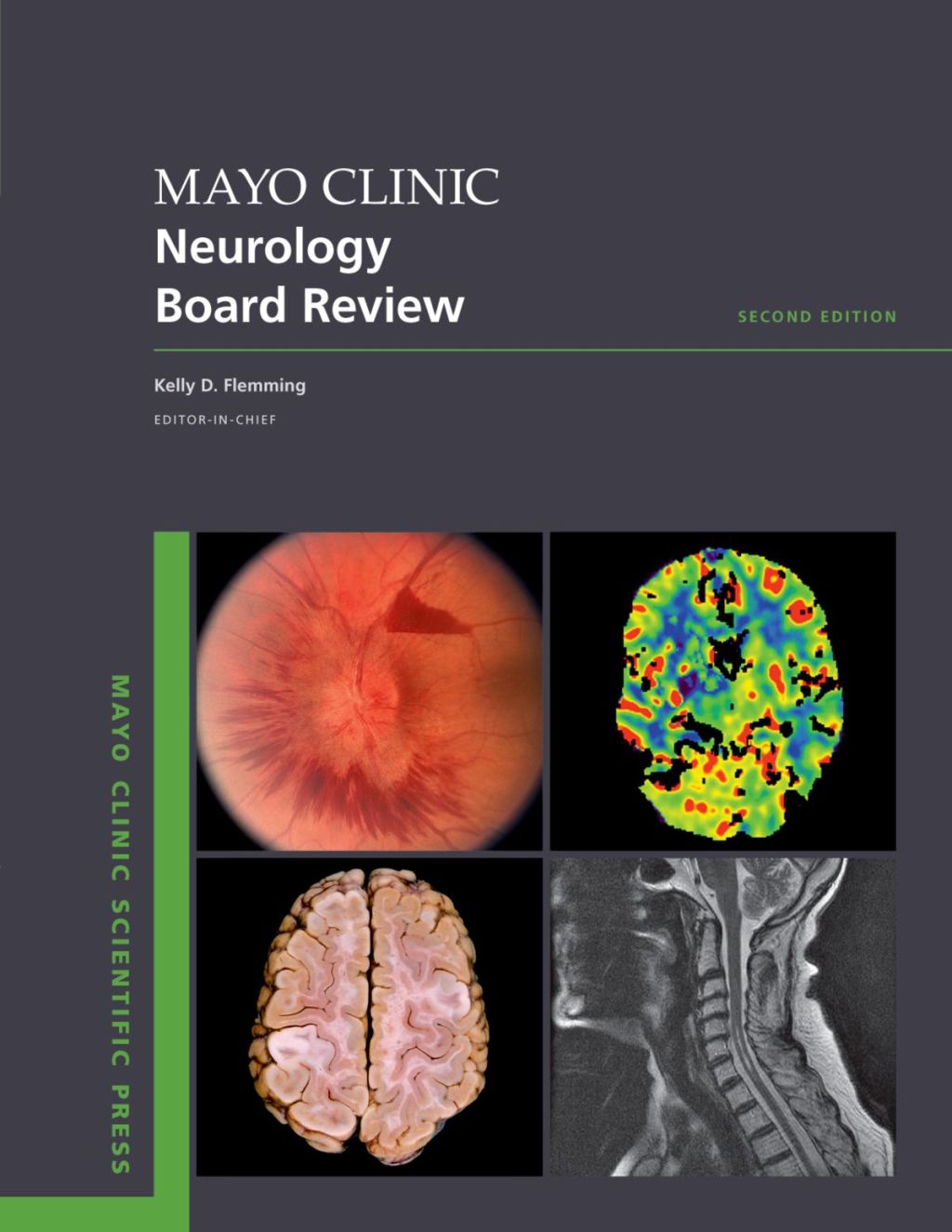 Mayo Clinic Neurology Board Review 2nd Edition â€“ PDF/EPUB Version Downloadable