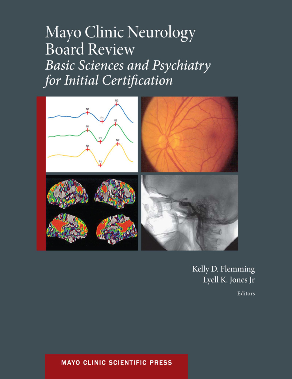 Mayo Clinic Neurology Board Review Basic Sciences and Psychiatry for Initial Certification 1st Edition â€“ PDF/EPUB Version Downloadable