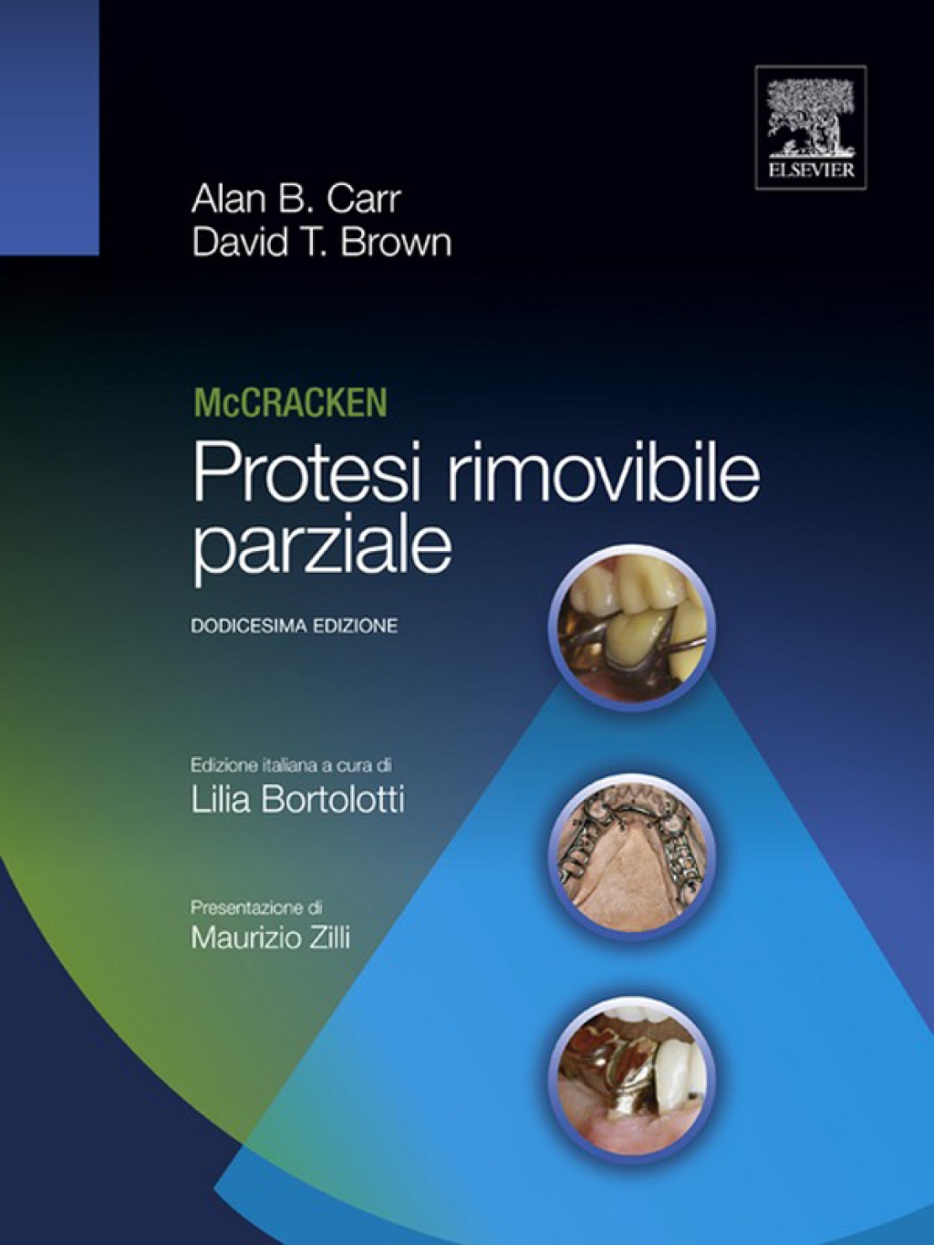 Mc Cracken Protesi rimovibile parziale 12th Edition â€“ PDF/EPUB Version Downloadable