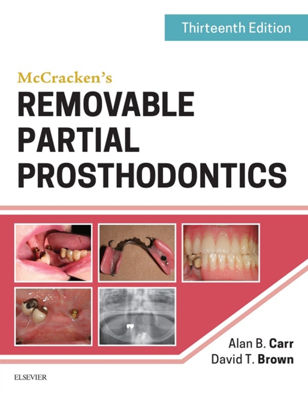 McCracken's Removable Partial Prosthodontics 13th Edition â€“ PDF/EPUB Version Downloadable