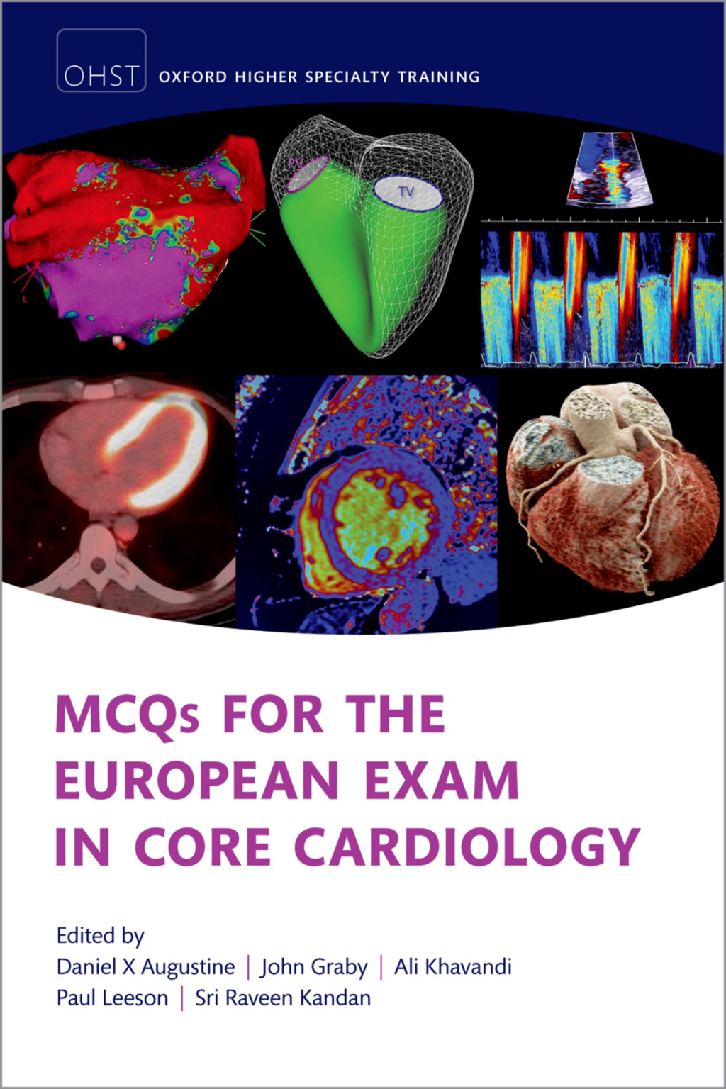 MCQs for the European Exam in Core Cardiology 2nd Edition â€“ PDF/EPUB Version Downloadable