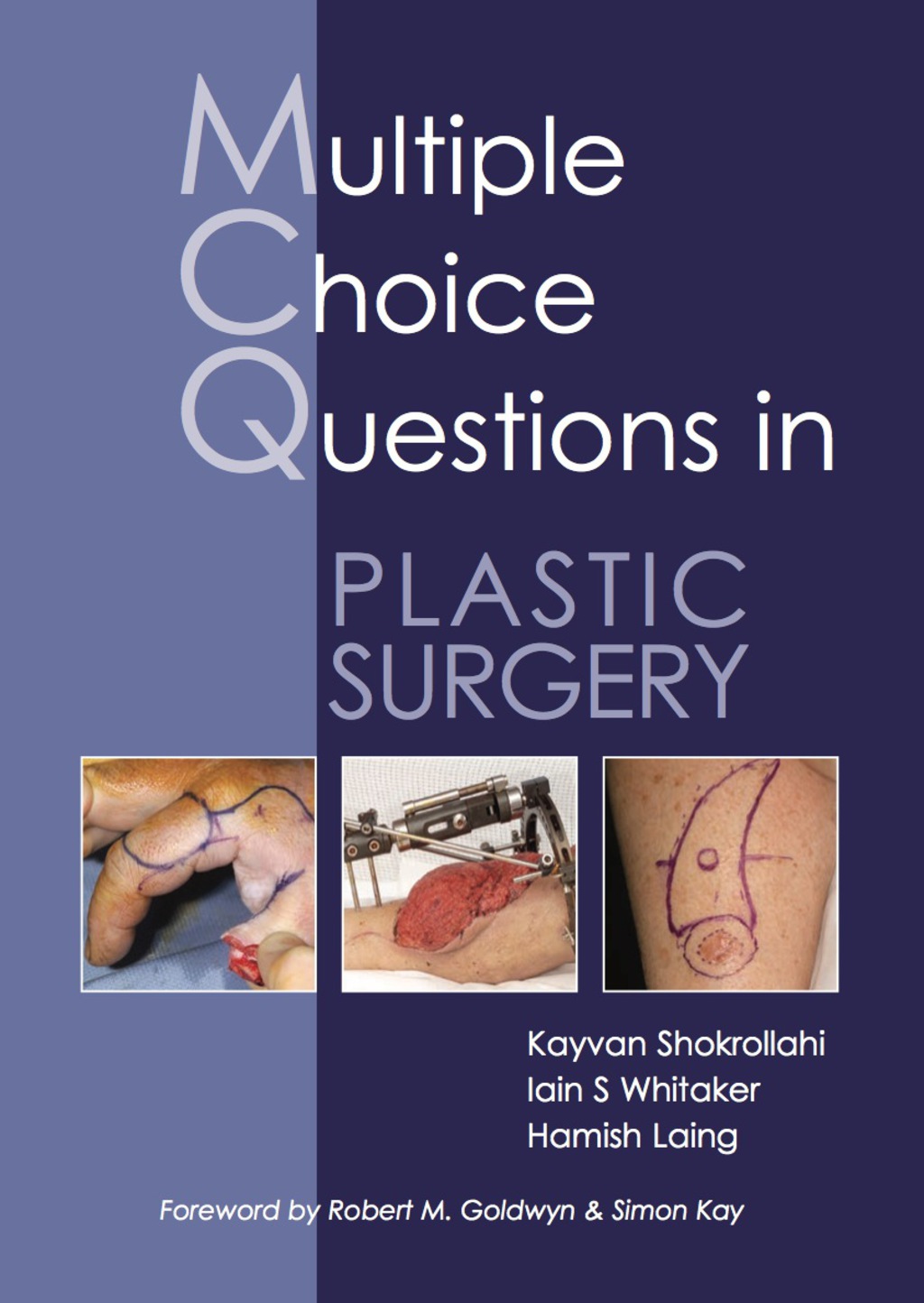 MCQs in Plastic Surgery 1st Edition â€“ PDF/EPUB Version Downloadable