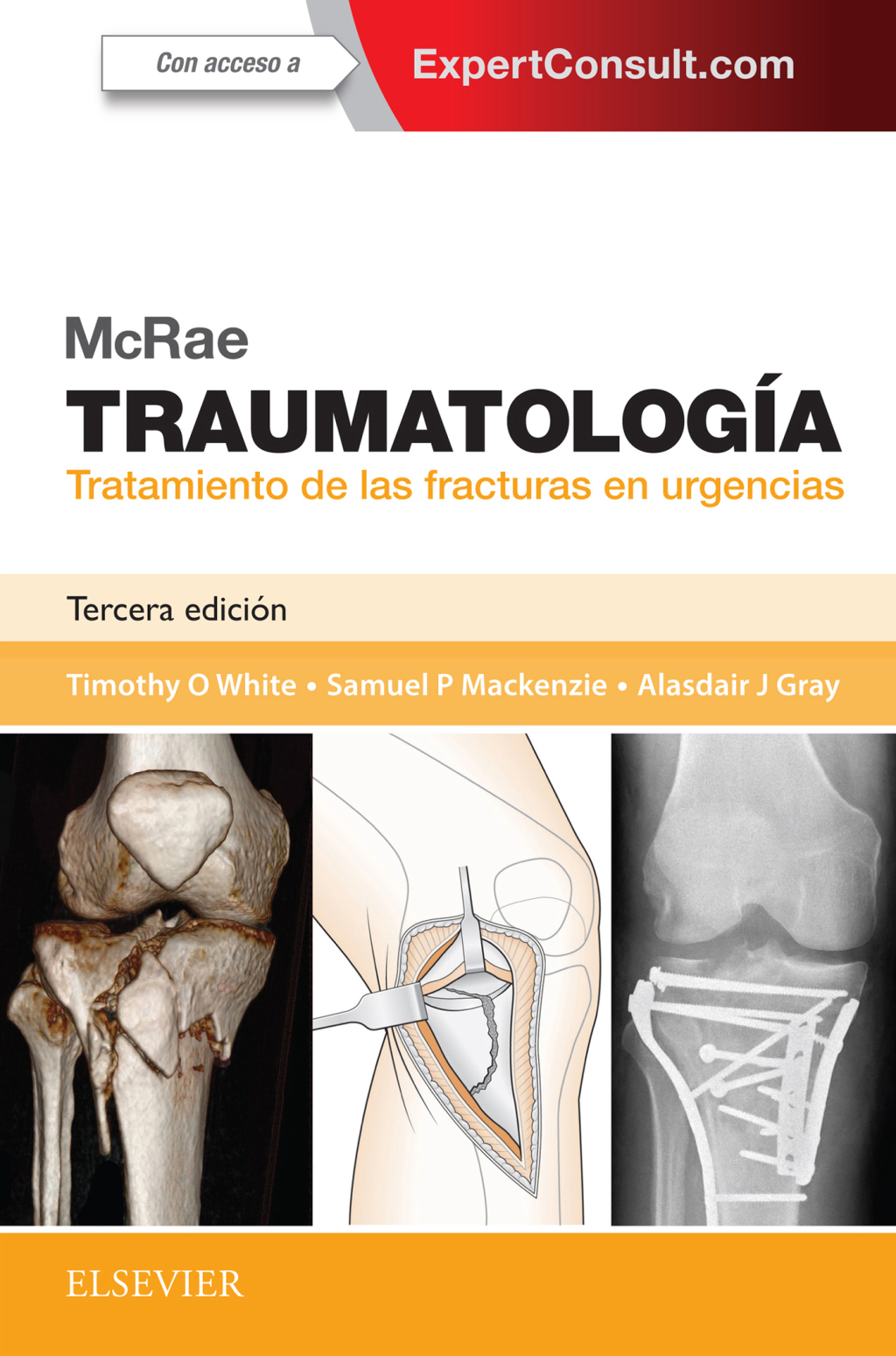 McRae. TraumatologÃ­a. Tratamiento de las fracturas en urgencias 3rd Edition â€“ PDF/EPUB Version Downloadable