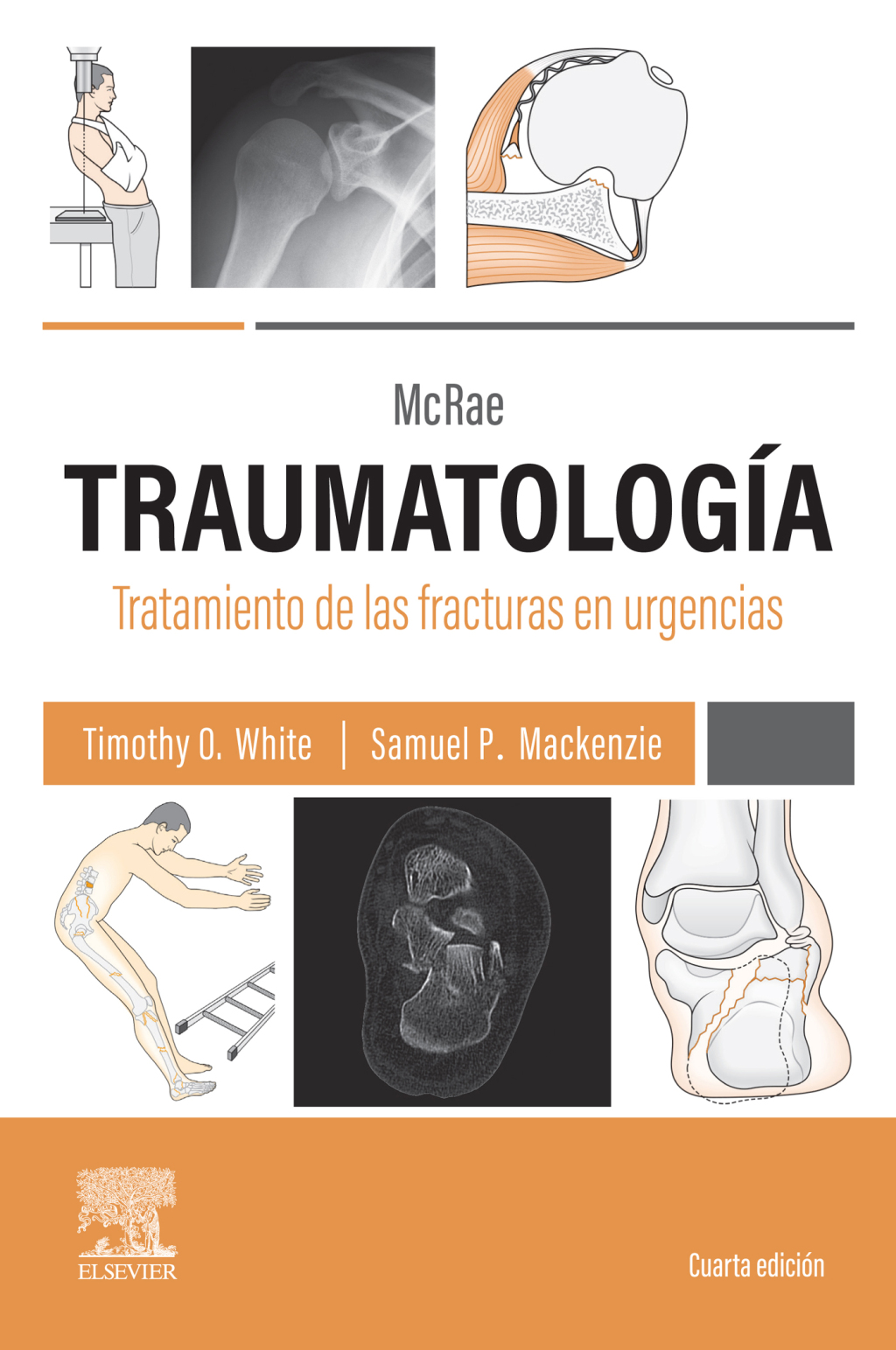 McRae. TraumatologÃ­a. Tratamiento de las fracturas en urgencias 4th Edition â€“ PDF/EPUB Version Downloadable