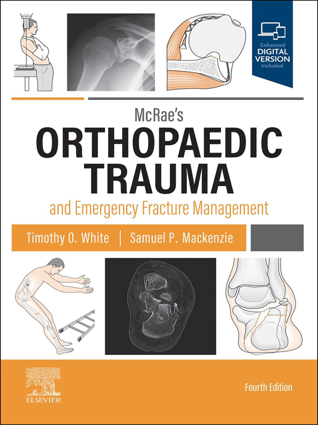 McRae's Orthopaedic Trauma and Emergency Fracture Management 4th Edition â€“ PDF/EPUB Version Downloadable