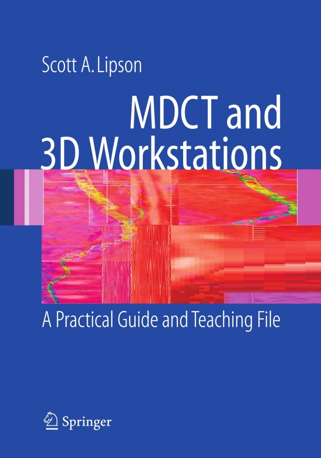 MDCT and 3D Workstations A Practical How-To Guide and Teaching File  â€“ PDF/EPUB Version Downloadable