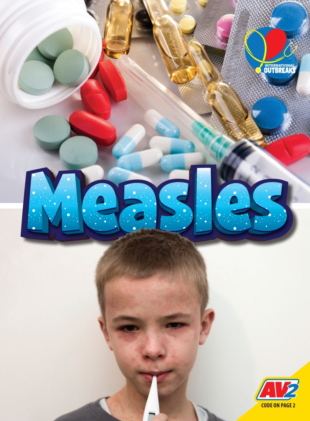 Measles 1st Edition â€“ PDF/EPUB Version Downloadable