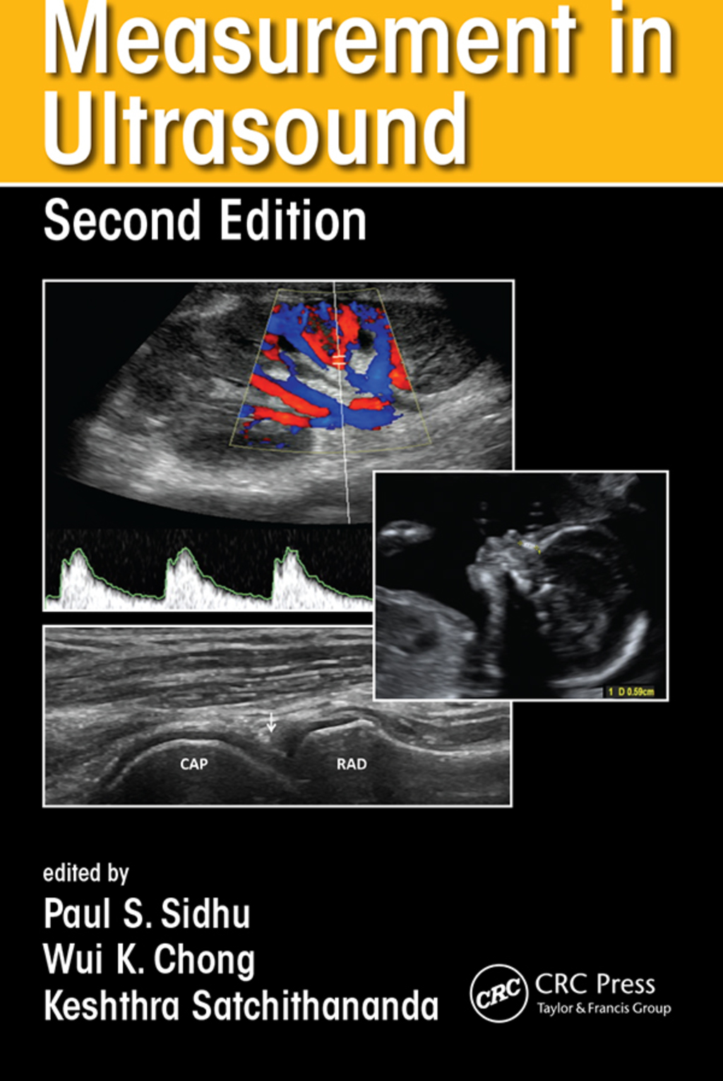 Measurement in Ultrasound 2nd Edition â€“ PDF/EPUB Version Downloadable