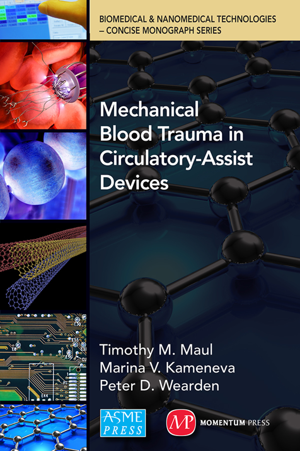 Mechanical Blood Trauma in Circulatory-Assist Devices  â€“ PDF/EPUB Version Downloadable