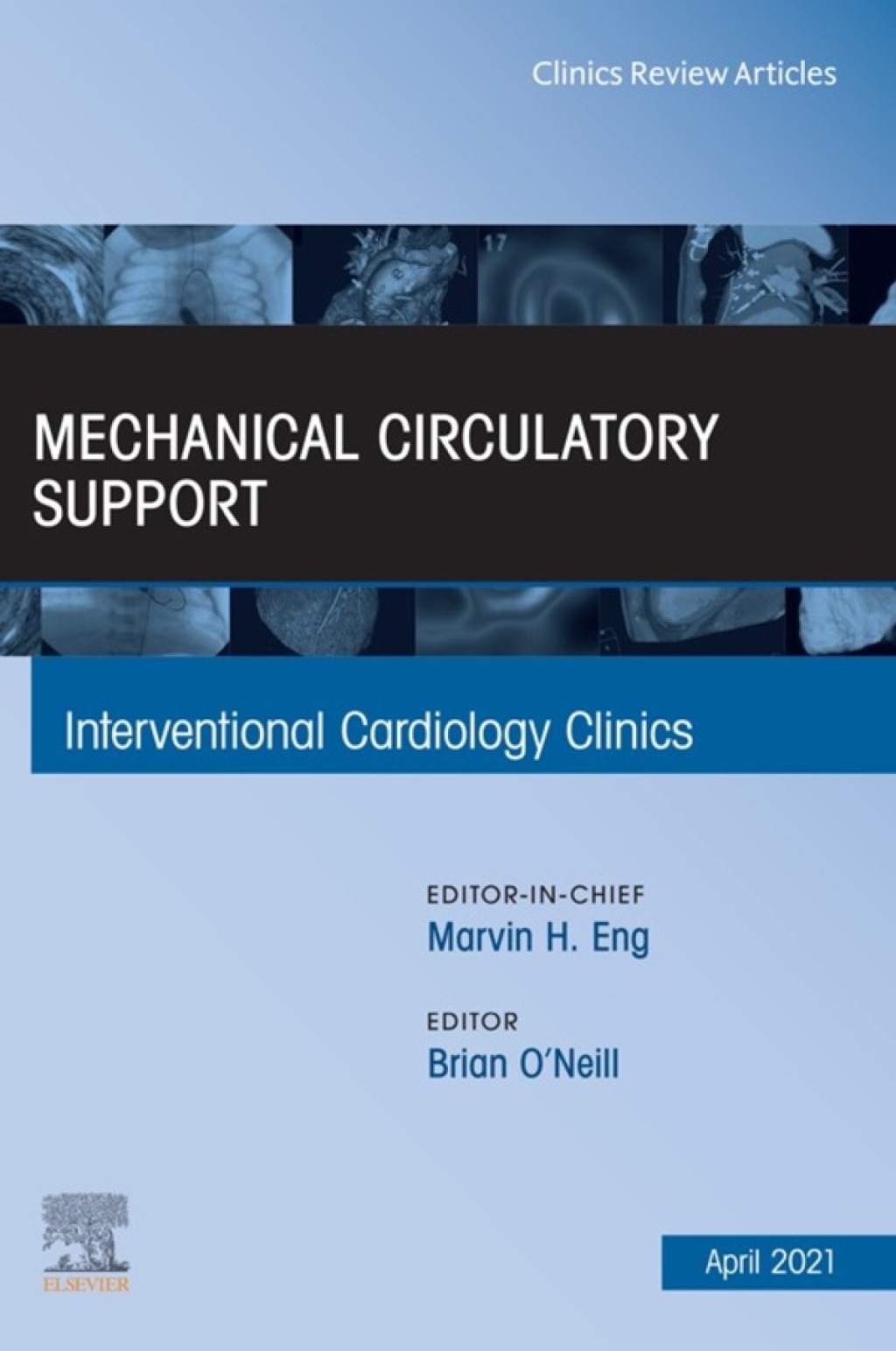 Mechanical Circulatory Support, An Issue of Interventional Cardiology Clinics  â€“ PDF/EPUB Version Downloadable