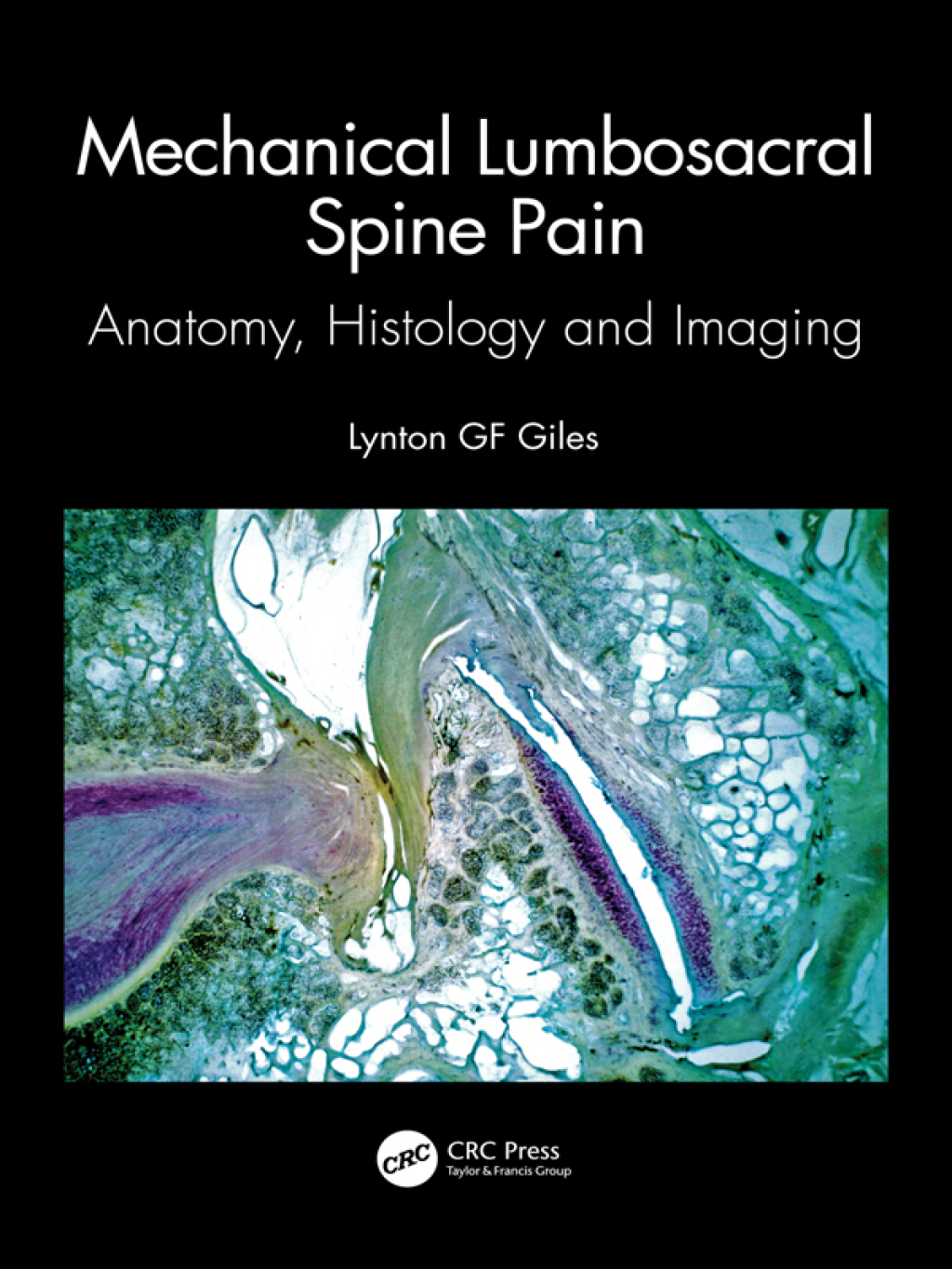Mechanical Lumbosacral Spine Pain Anatomy, Histology and Imaging 1st Edition â€“ PDF/EPUB Version Downloadable