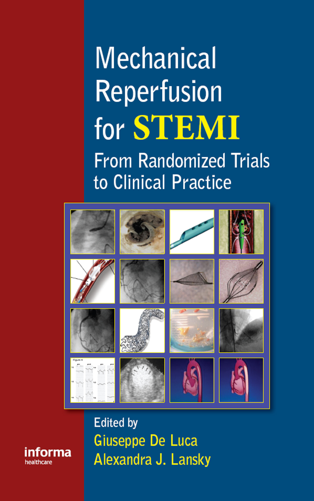 Mechanical Reperfusion for STEMI From Randomized Trials to Clinical Practice 1st Edition â€“ PDF/EPUB Version Downloadable