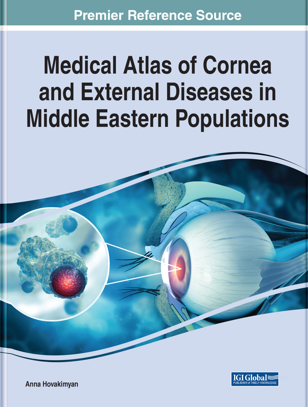 Medical Atlas of Cornea and External Diseases in Middle Eastern Populations  â€“ PDF/EPUB Version Downloadable