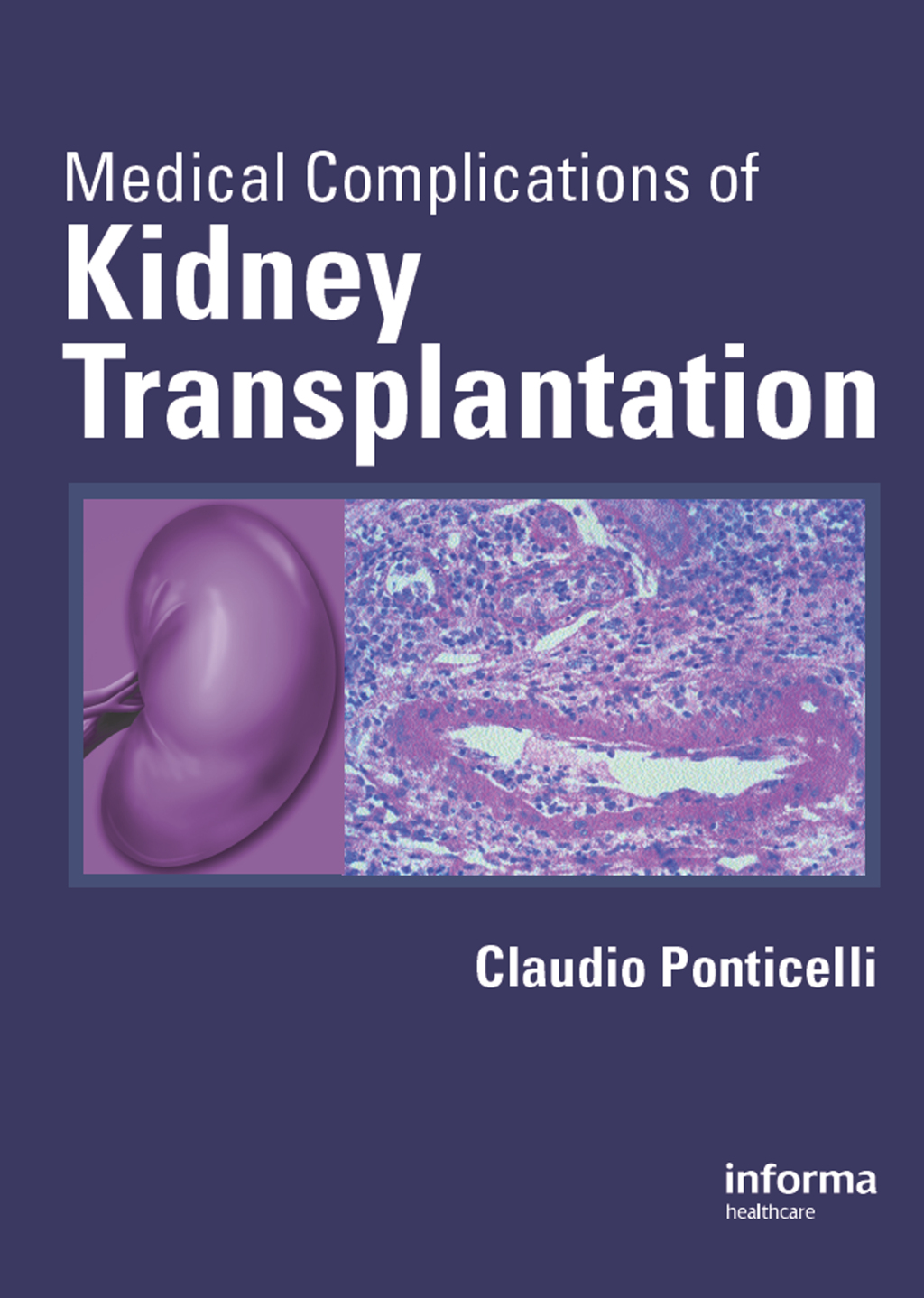 Medical Complications of Kidney Transplantation 1st Edition â€“ PDF/EPUB Version Downloadable