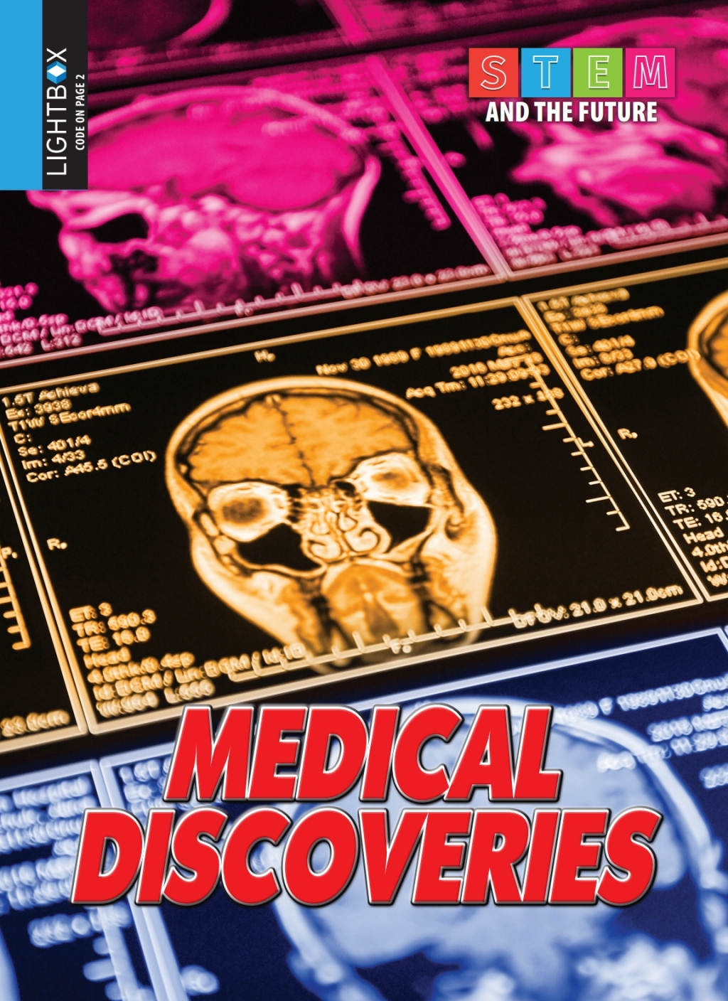 Medical Discoveries 1st Edition â€“ PDF/EPUB Version Downloadable