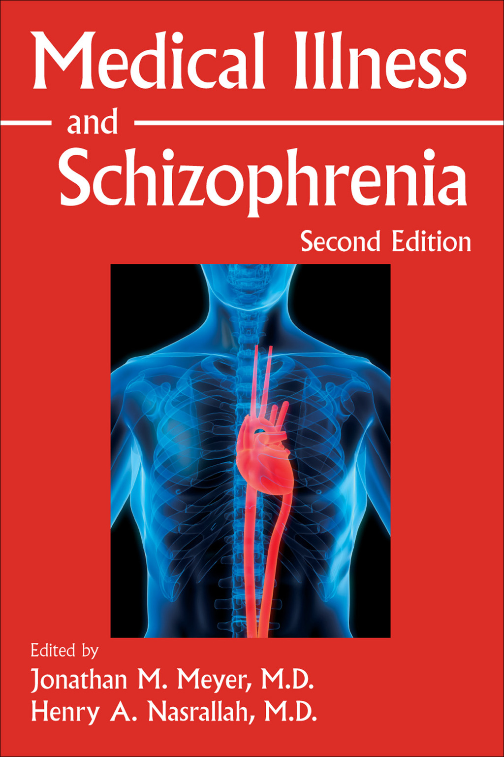 Medical Illness and Schizophrenia 2nd Edition â€“ PDF/EPUB Version Downloadable
