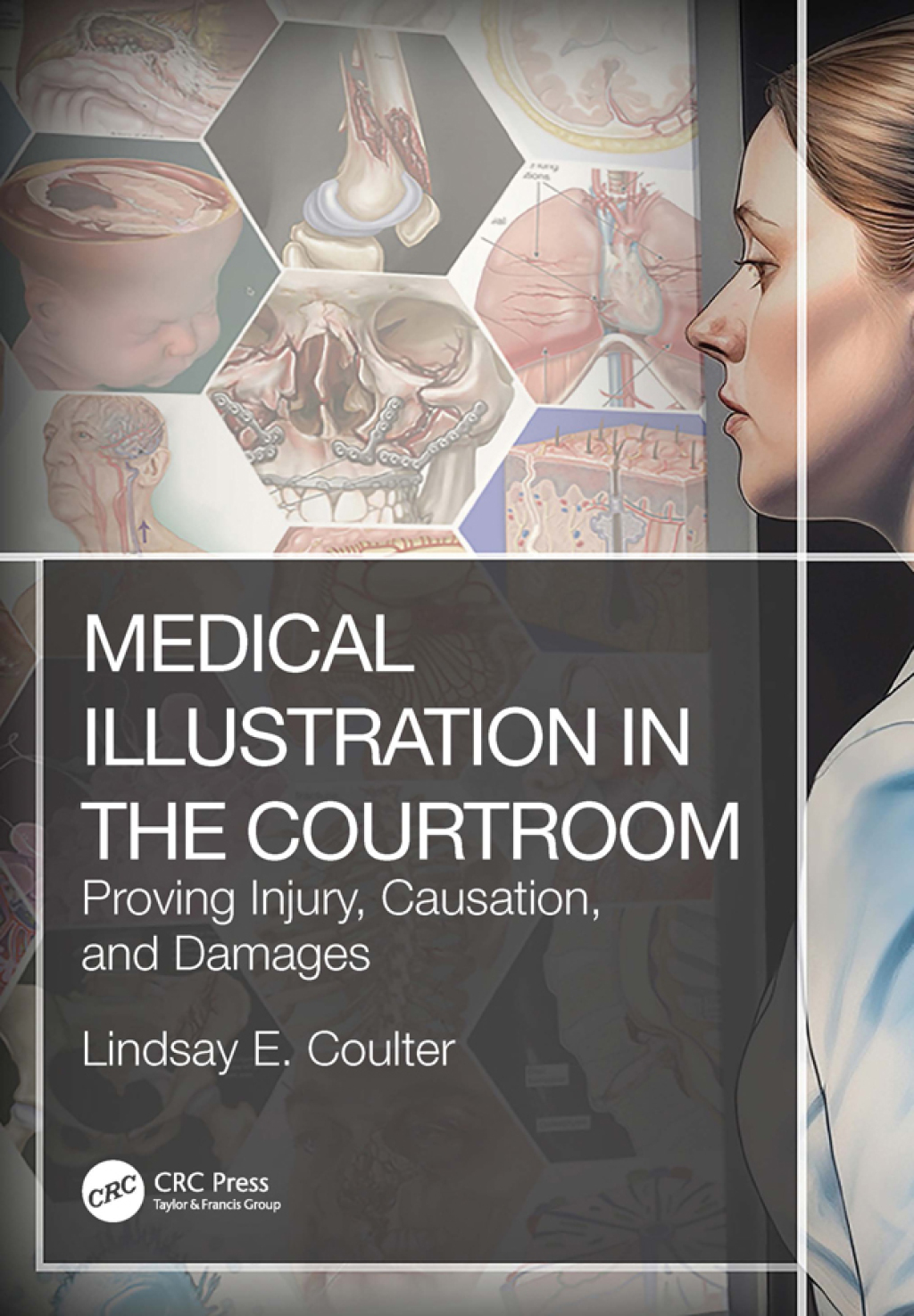 Medical Illustration in the Courtroom Proving Injury, Causation, and Damages 1st Edition â€“ PDF/EPUB Version Downloadable