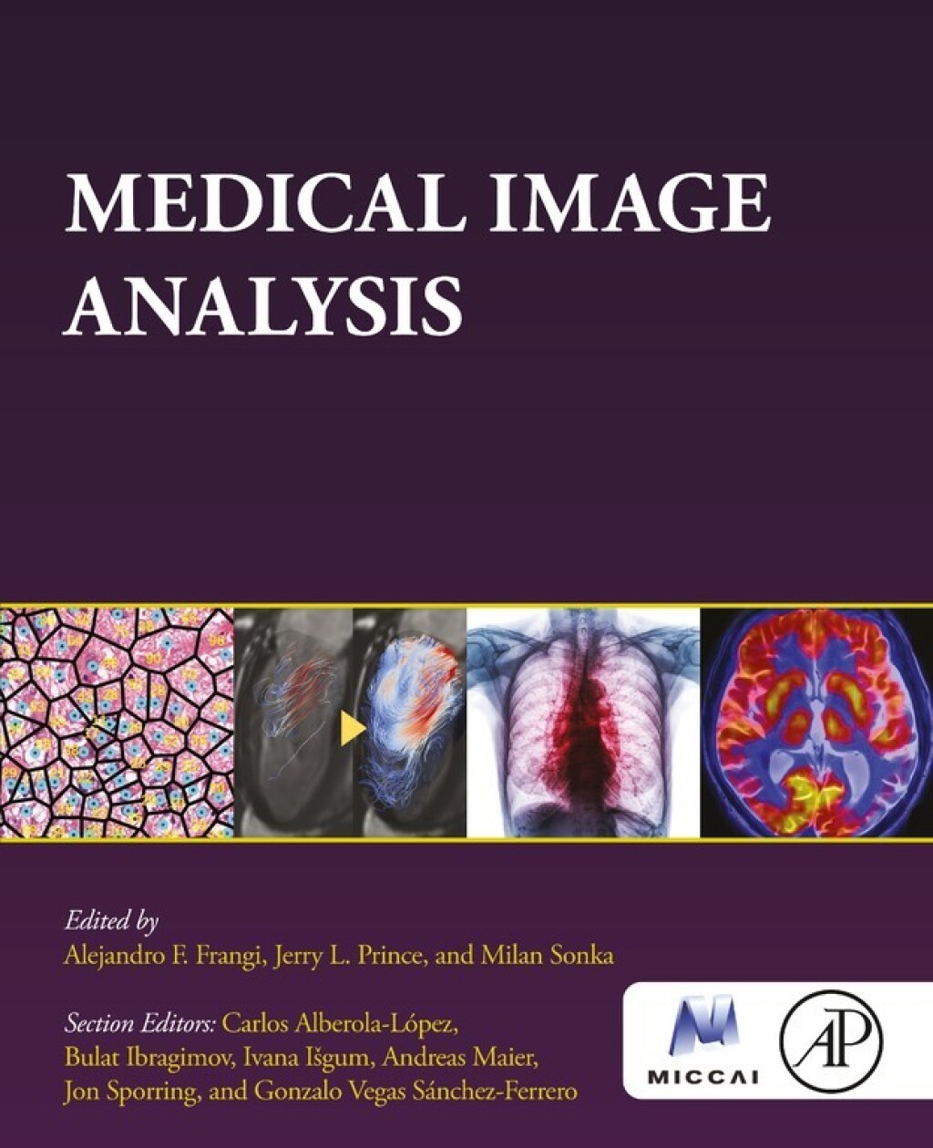 Medical Image Analysis 1st Edition â€“ PDF/EPUB Version Downloadable