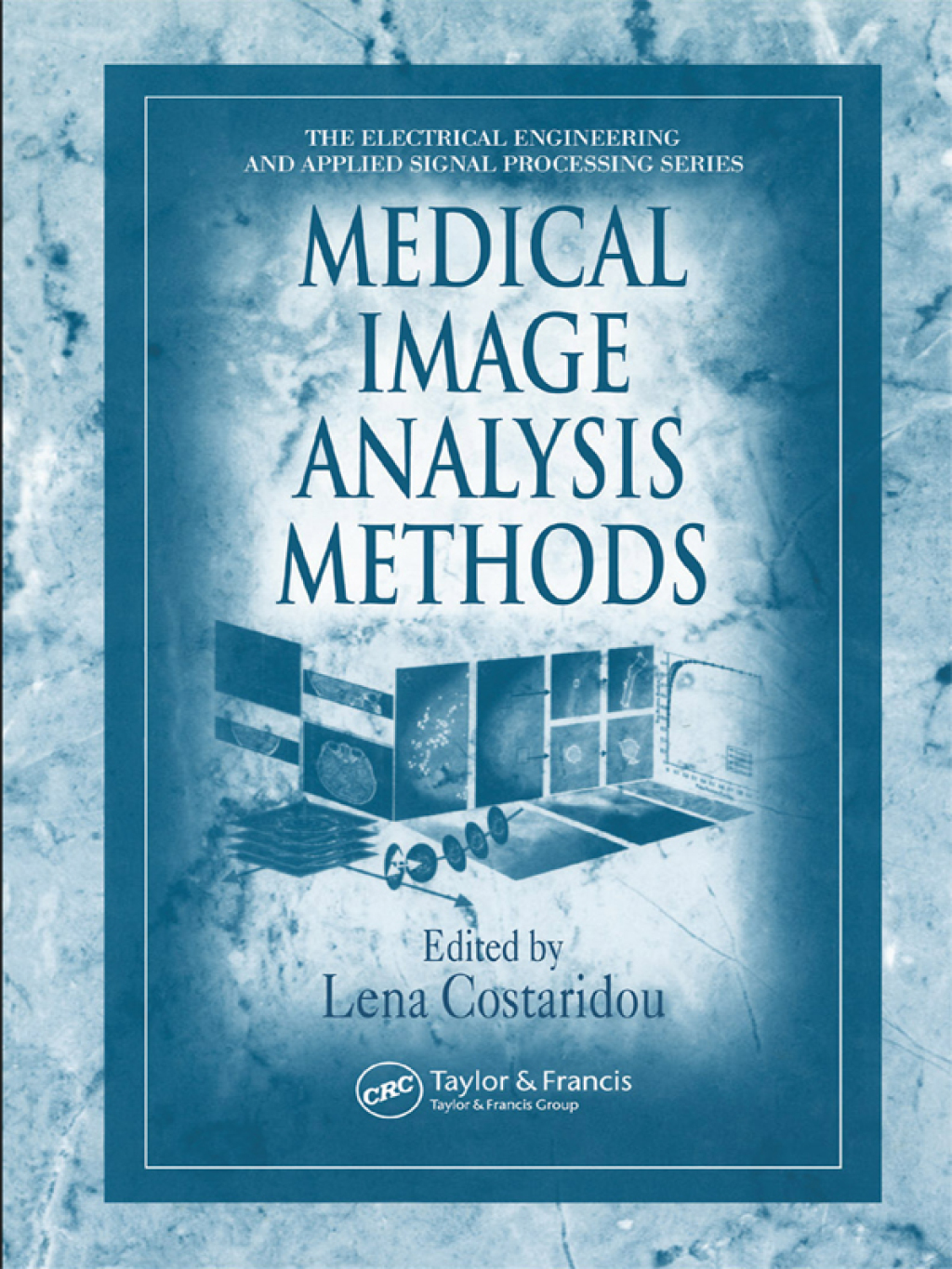 Medical Image Analysis Methods 1st Edition â€“ PDF/EPUB Version Downloadable