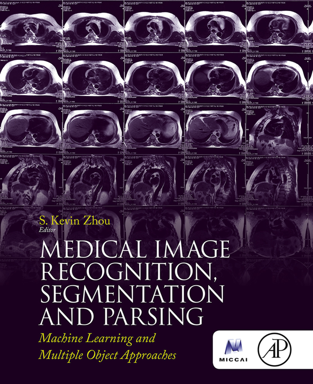 Medical Image Recognition, Segmentation and Parsing: Machine Learning and Multiple Object Approaches  â€“ PDF/EPUB Version Downloadable