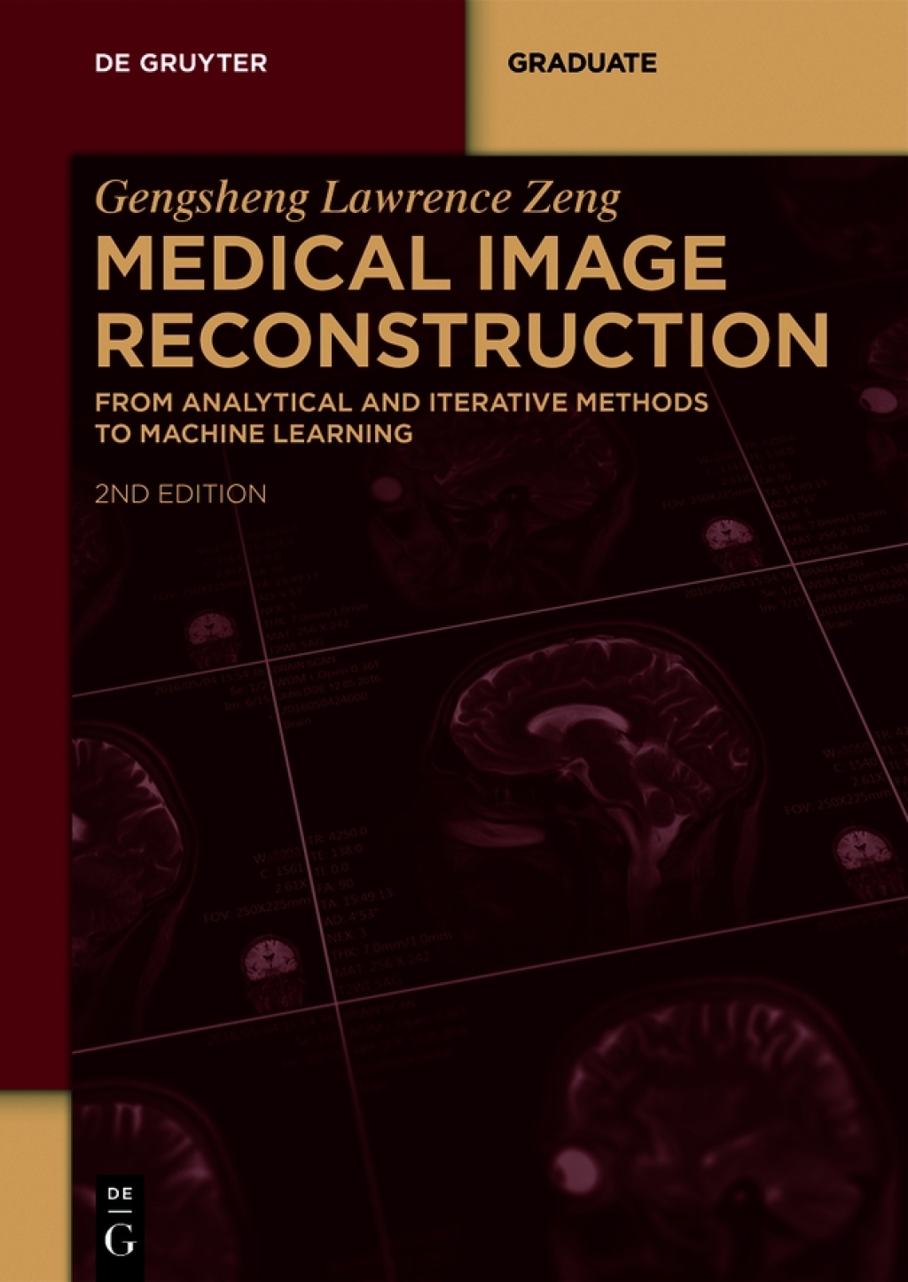 Medical Image Reconstruction From Analytical and Iterative Methods to Machine Learning 2nd Edition â€“ PDF/EPUB Version Downloadable