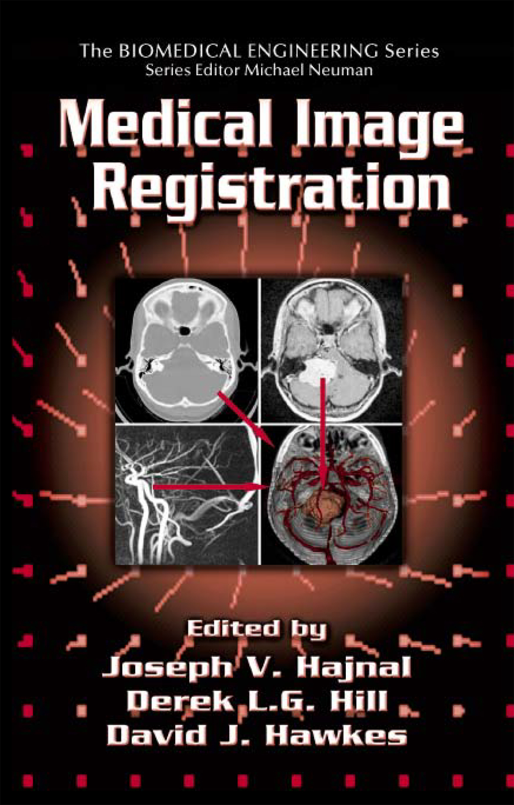 Medical Image Registration 1st Edition â€“ PDF/EPUB Version Downloadable