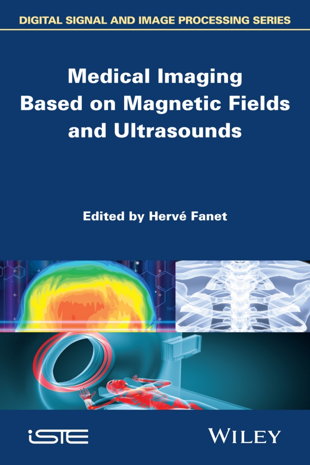 Medical Imaging Based on Magnetic Fields and Ultrasounds 1st Edition â€“ PDF/EPUB Version Downloadable