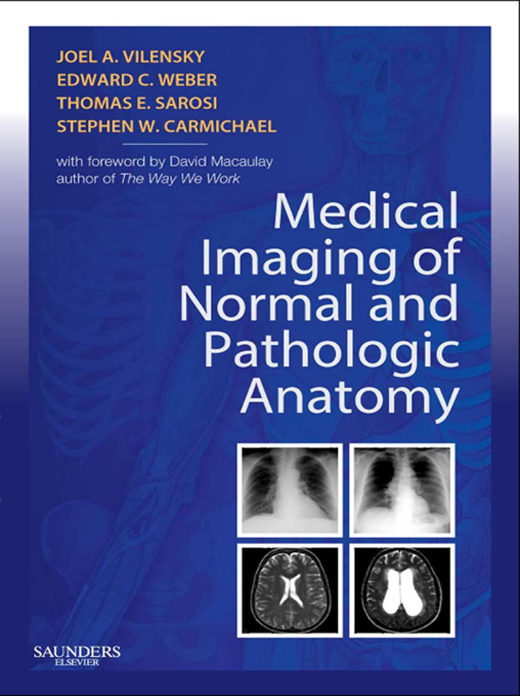 Medical Imaging of Normal and Pathologic Anatomy - (PDF/EPUB Version)