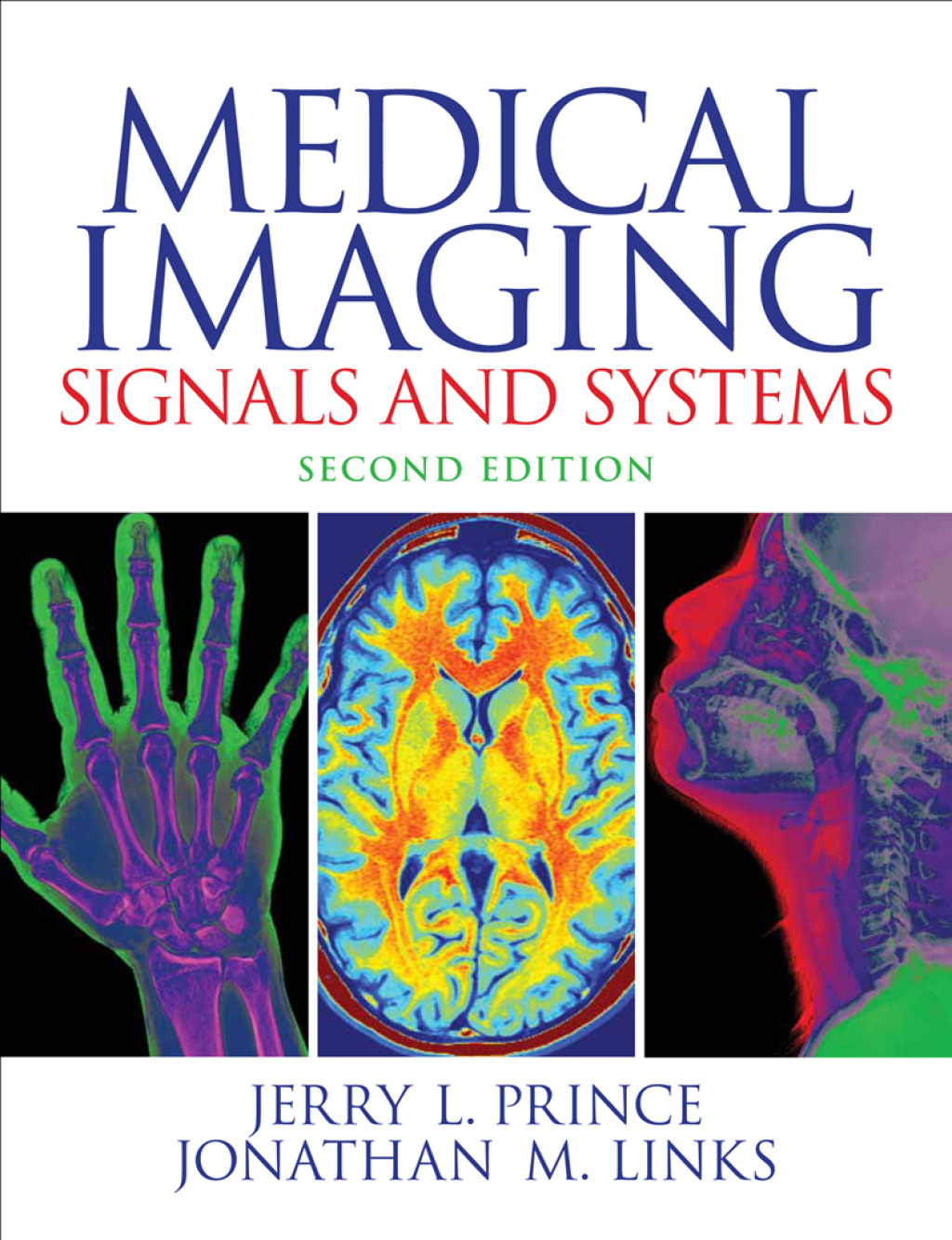 Medical Imaging Signals and Systems 2nd Edition â€“ PDF/EPUB Version Downloadable