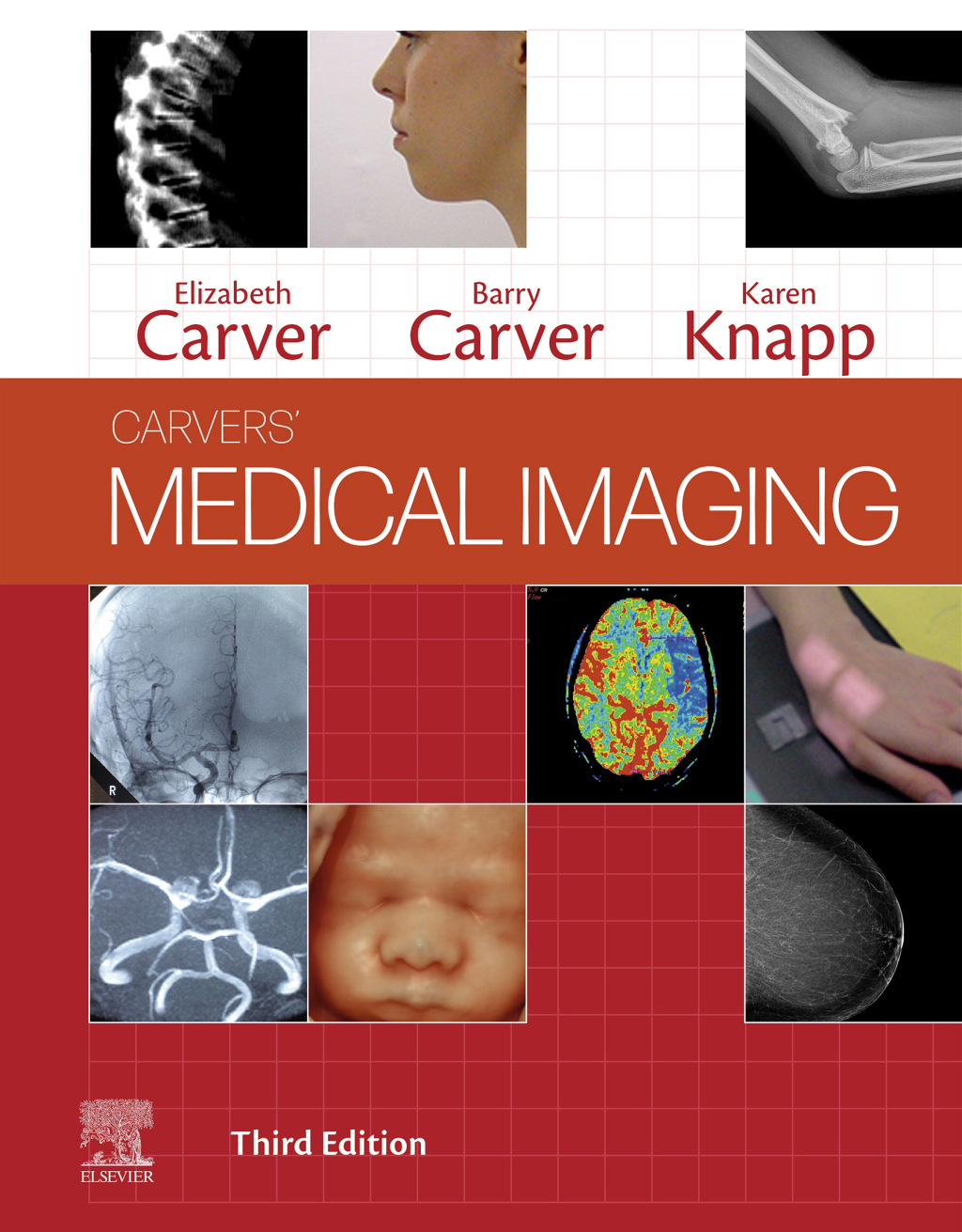 Medical Imaging Techniques, Reflection and Evaluation 3rd Edition â€“ PDF/EPUB Version Downloadable