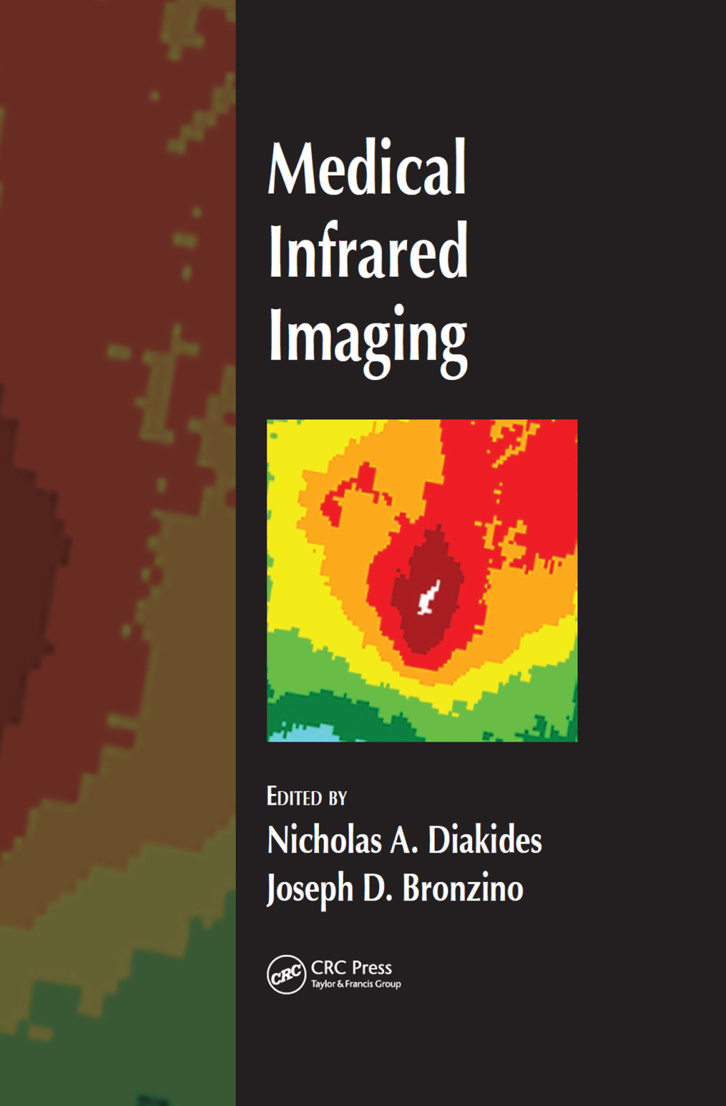 Medical Infrared Imaging 1st Edition â€“ PDF/EPUB Version Downloadable