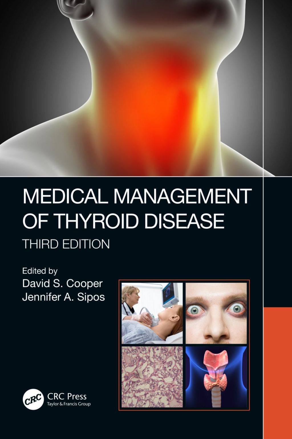 Medical Management of Thyroid Disease, Third Edition 3rd Edition â€“ PDF/EPUB Version Downloadable