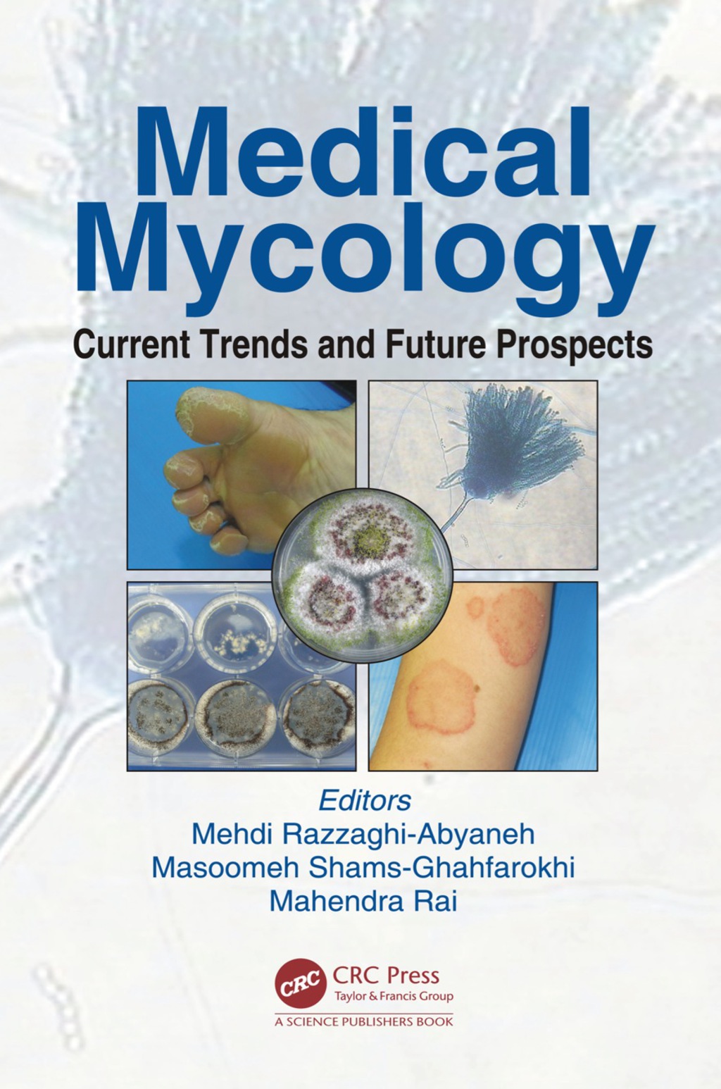 Medical Mycology Current Trends and Future Prospects 1st Edition â€“ PDF/EPUB Version Downloadable