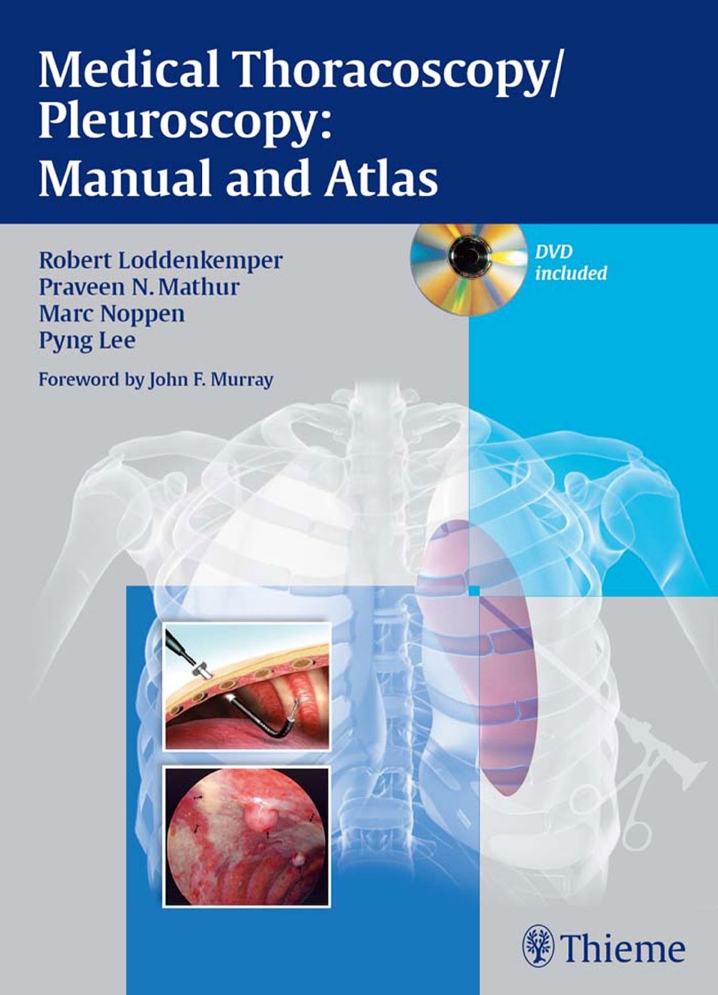 Medical Thoracoscopy / Pleuroscopy Manual and Atlas 1st Edition – PDF/EPUB Version Downloadable