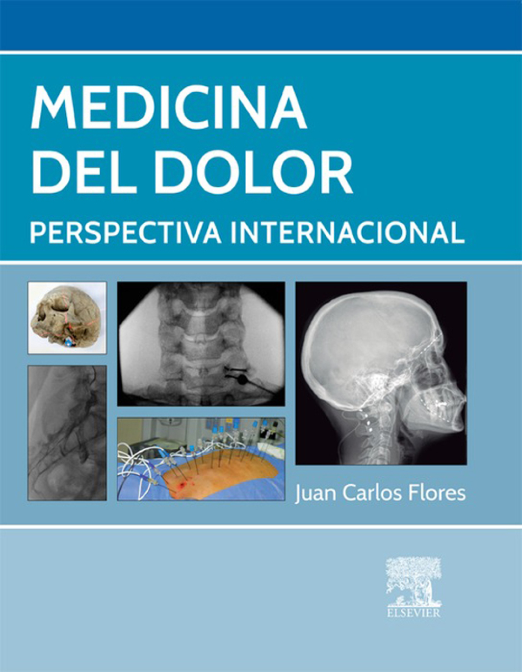 Medicina del dolor Perspectiva internacional  â€“ PDF/EPUB Version Downloadable