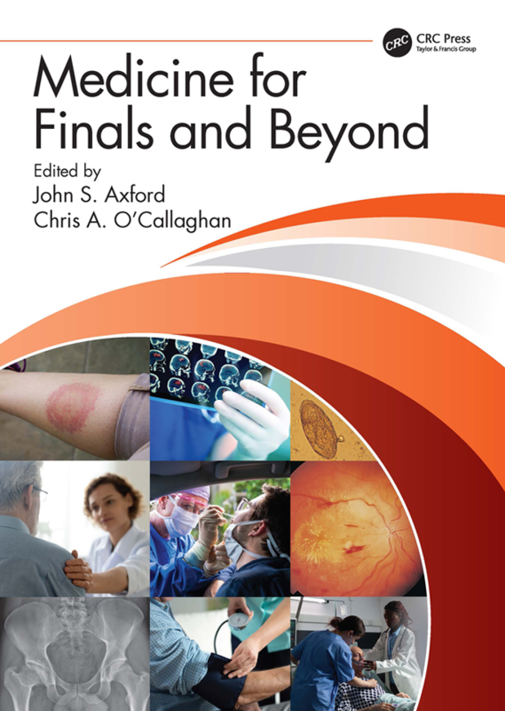 Medicine for Finals and Beyond 1st Edition â€“ PDF/EPUB Version Downloadable