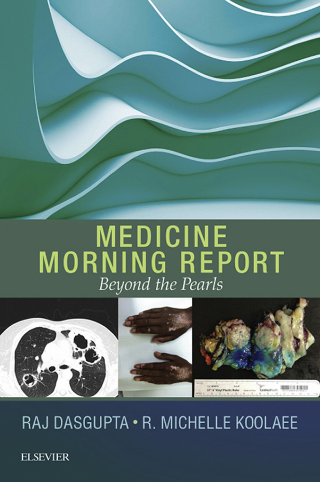 Medicine Morning Report: Beyond the Pearls E-Book - (PDF/EPUB Version)