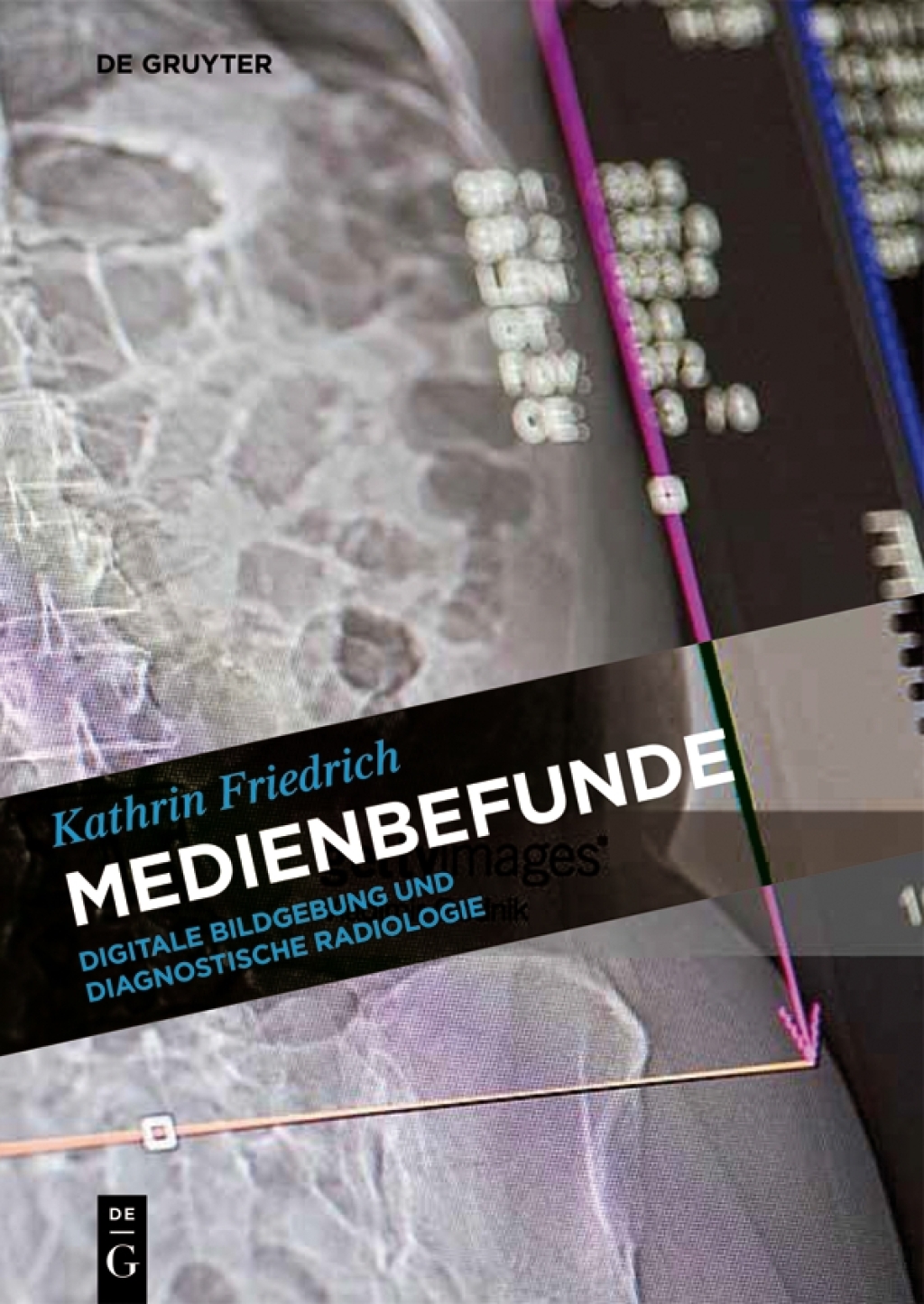 Medienbefunde Digitale Bildgebung und diagnostische Radiologie 1st Edition â€“ PDF/EPUB Version Downloadable