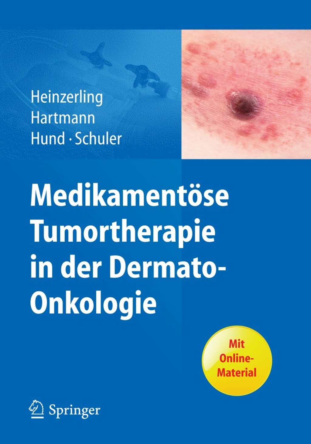 MedikamentÃ¶se Tumortherapie in der Dermato-Onkologie  â€“ PDF/EPUB Version Downloadable