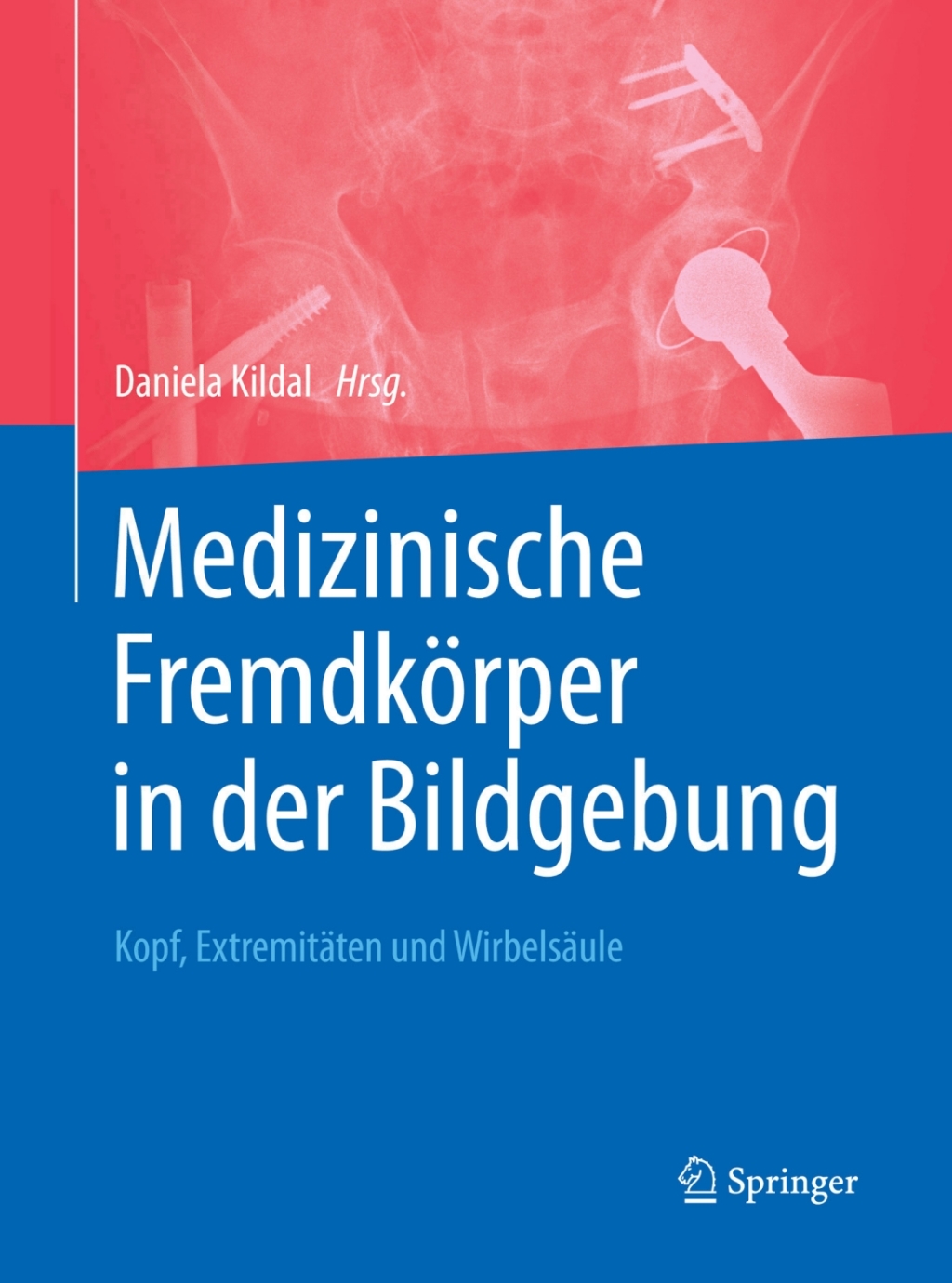 Medizinische FremdkÃ¶rper in der Bildgebung Kopf, ExtremitÃ¤ten und WirbelsÃ¤ule  â€“ PDF/EPUB Version Downloadable