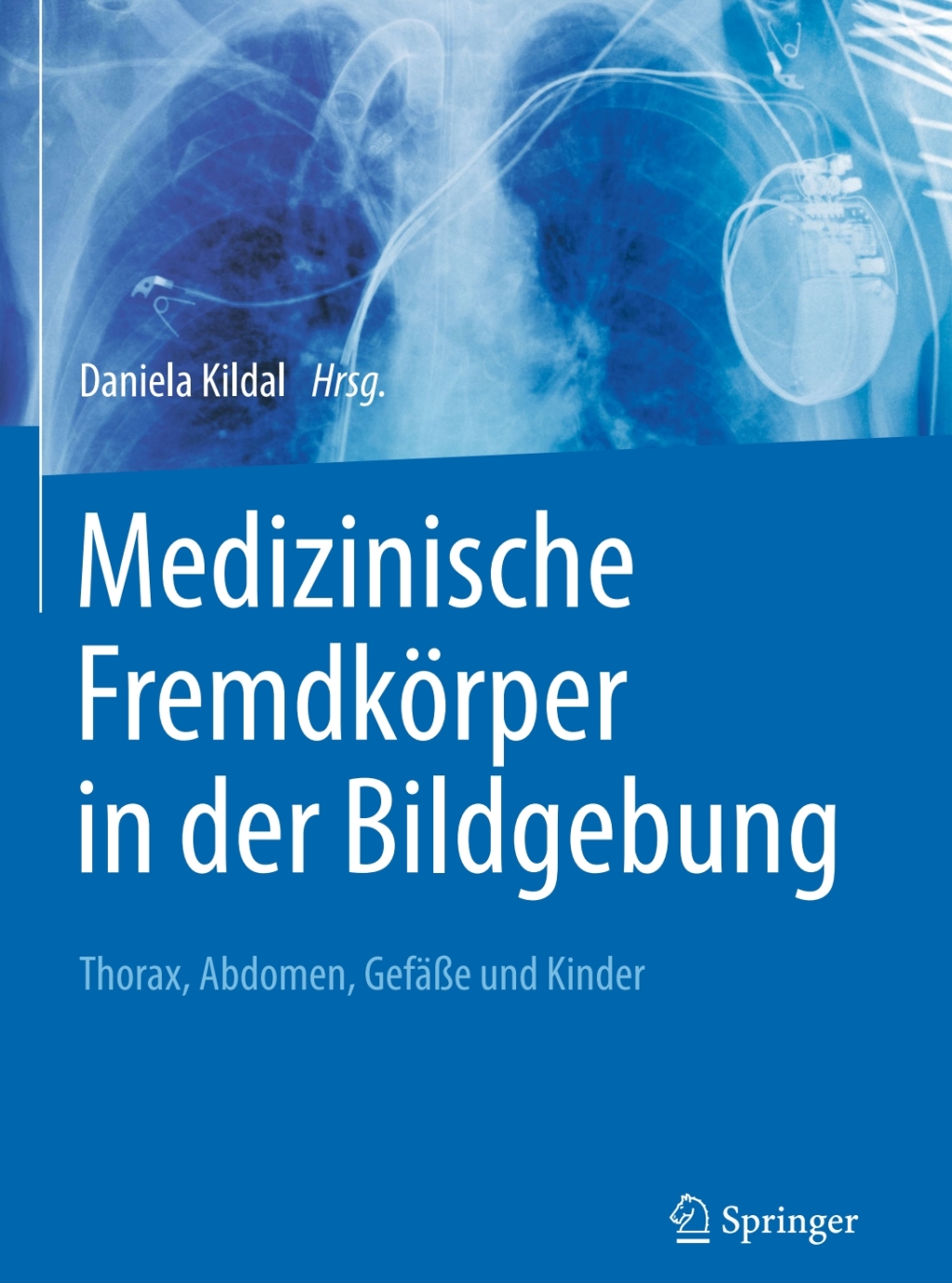 Medizinische FremdkÃ¶rper in der Bildgebung Thorax, Abdomen, GefÃ¤ÃŸe und Kinder  â€“ PDF/EPUB Version Downloadable