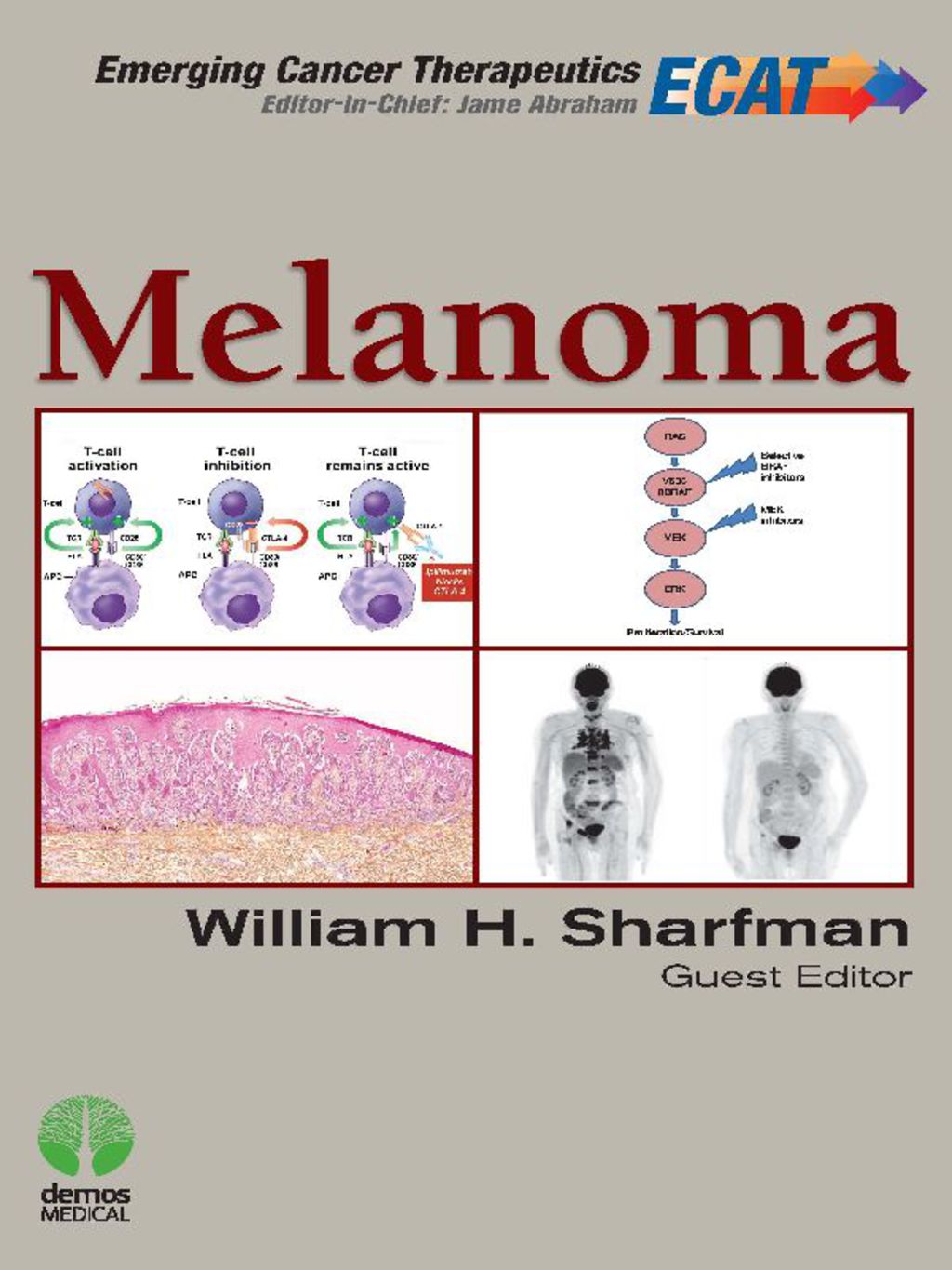 Melanoma 1st Edition â€“ PDF/EPUB Version Downloadable